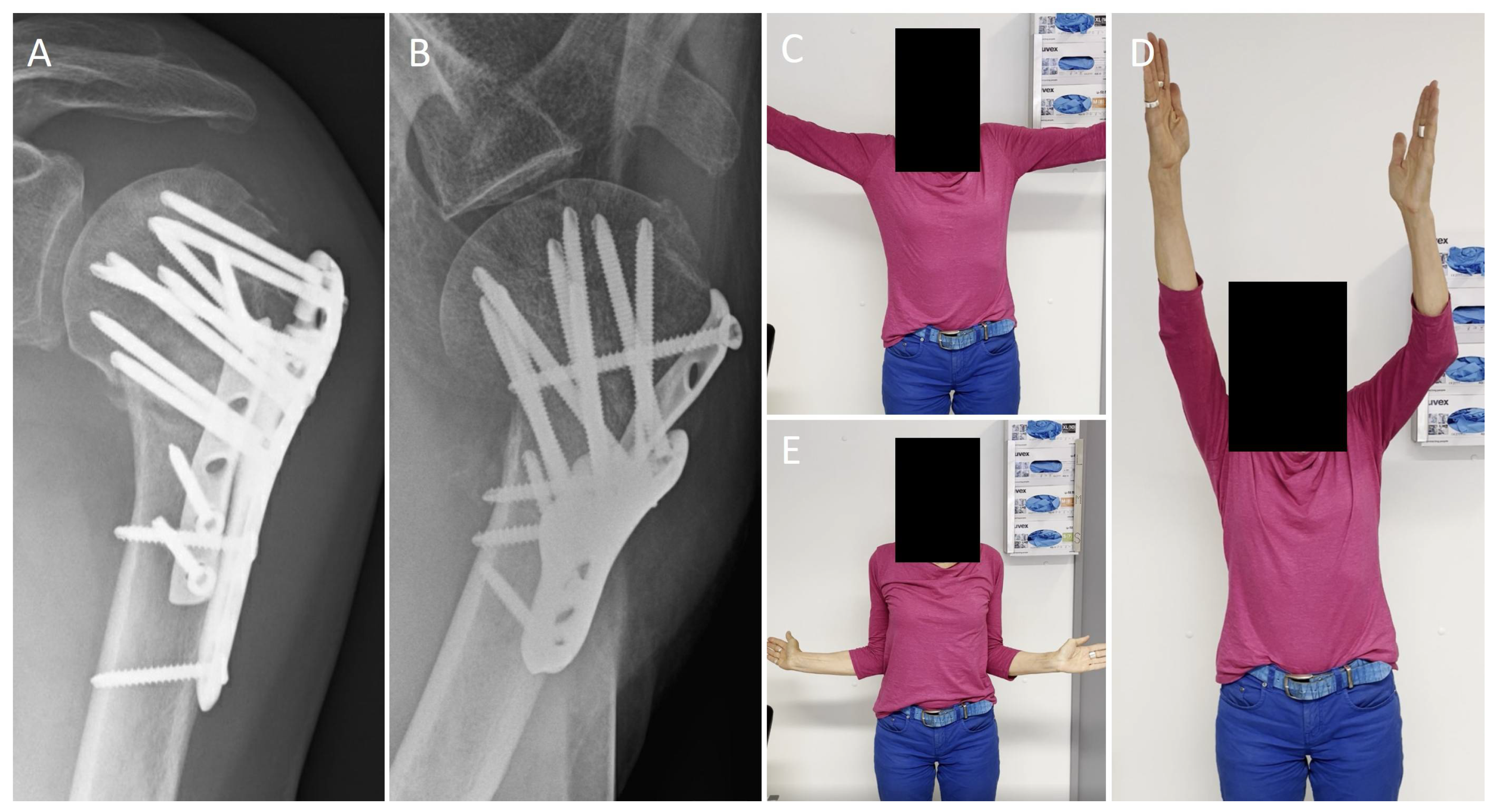 Jcm 12 00696 g003 Jcm 12 00696 g003