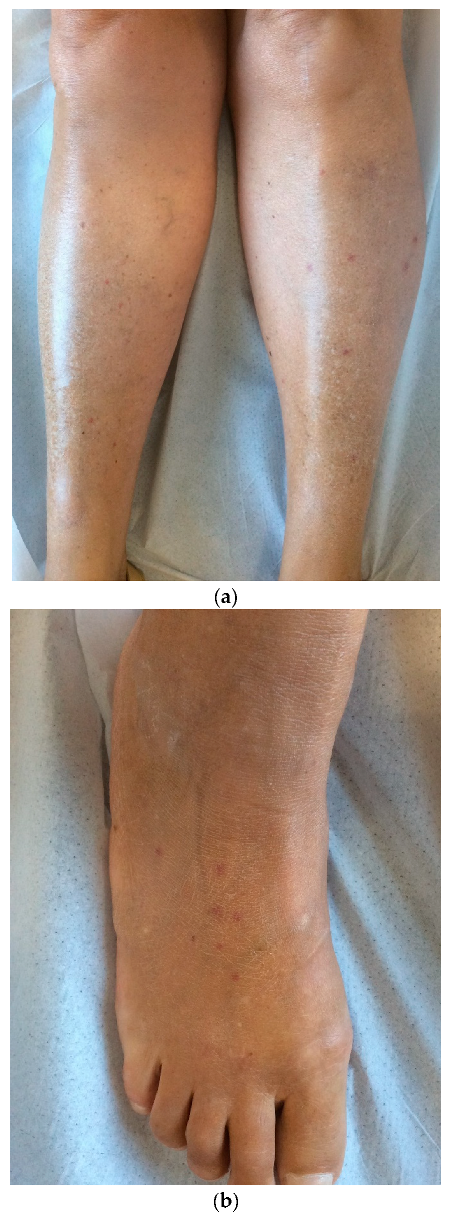 Jcm 12 00697 g005 Jcm 12 00697 g005