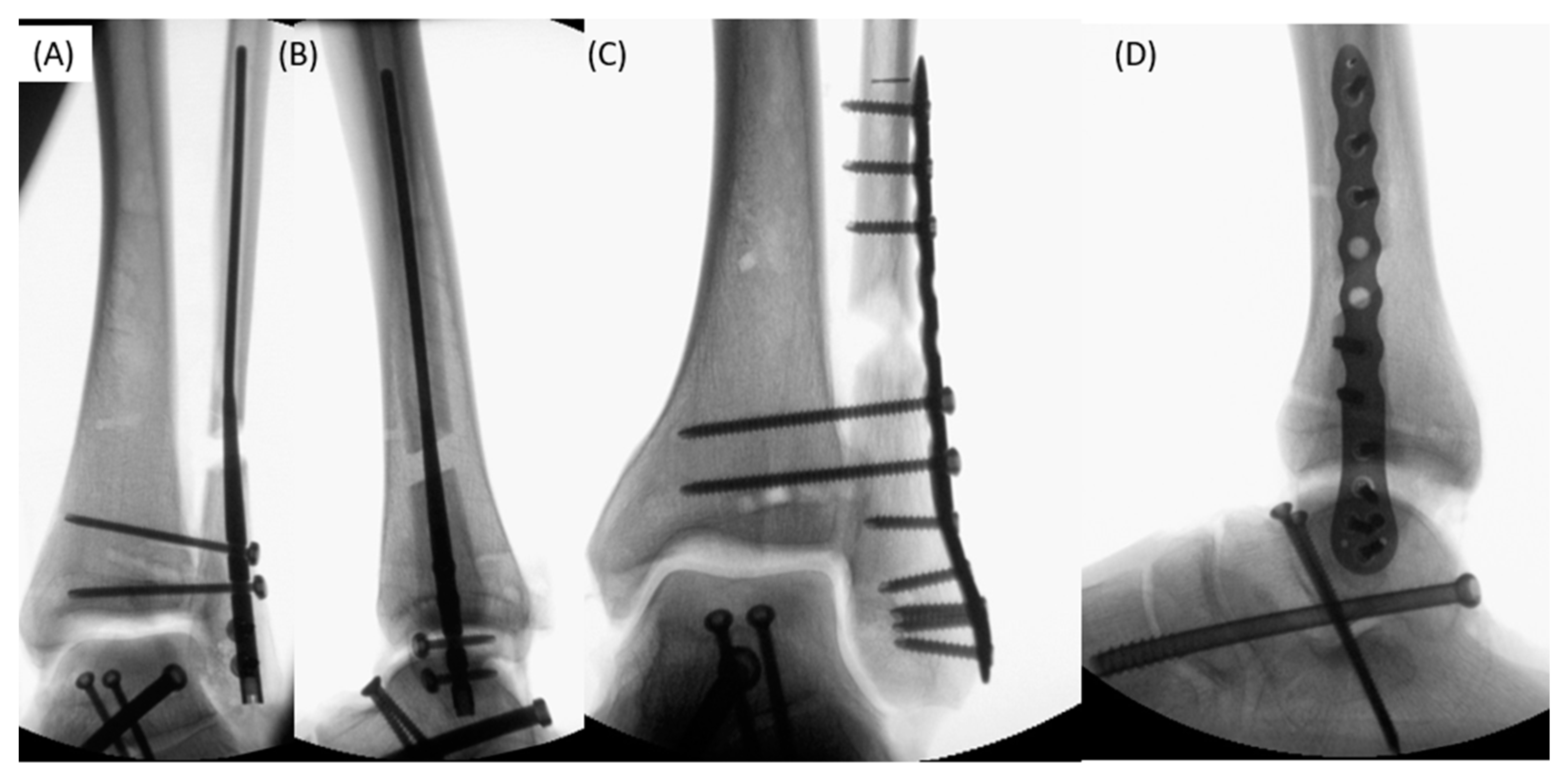 Jcm 12 00698 g001 Jcm 12 00698 g001