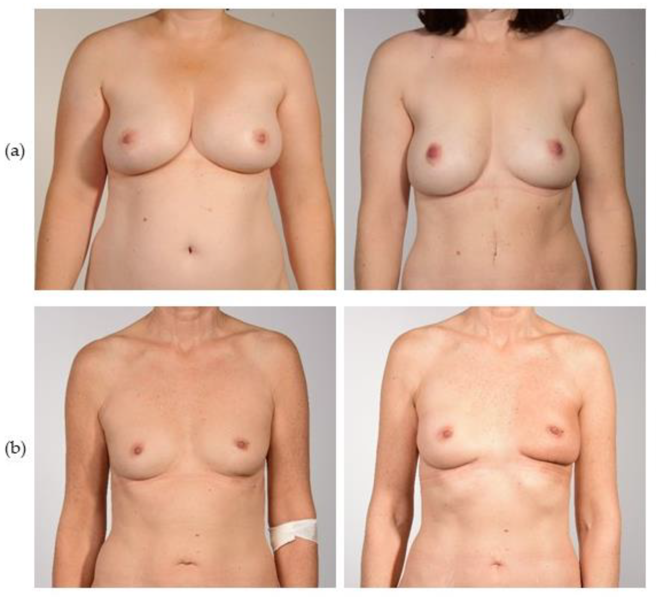 Jcm 12 00737 g001 Jcm 12 00737 g001