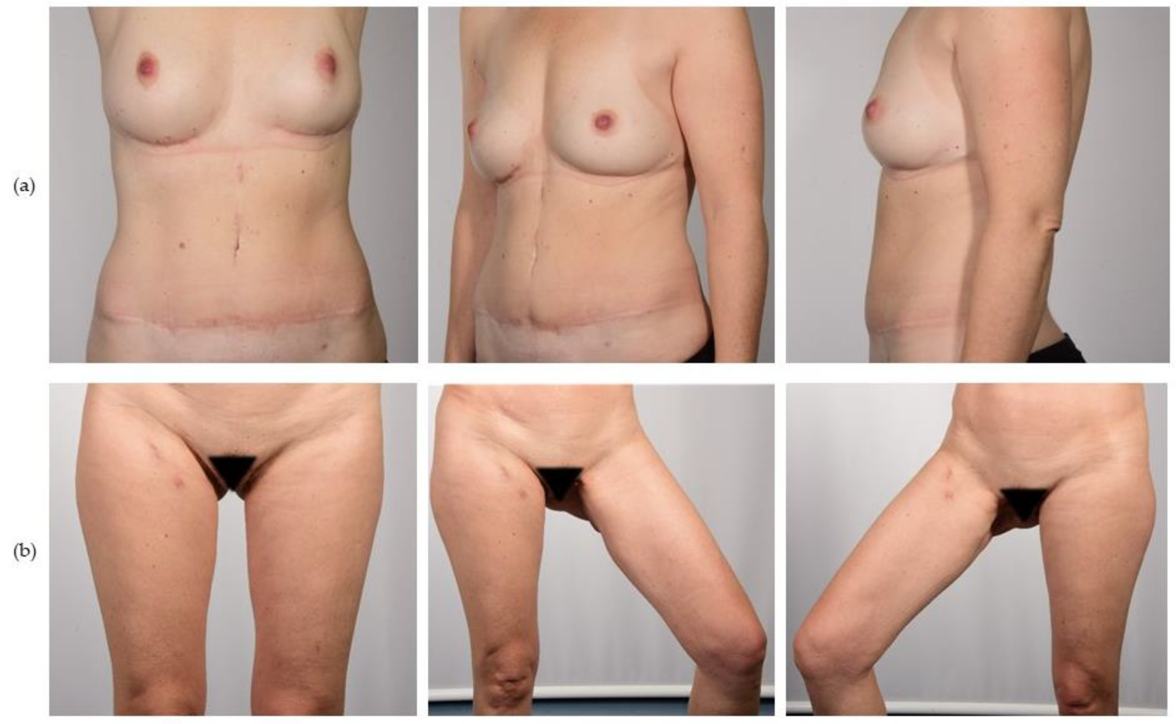 Jcm 12 00737 g004 Jcm 12 00737 g004