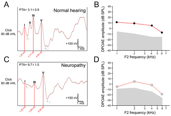 CRISPR-Cas9 correction of OPA1 c.1334G>A: p.R445H restores