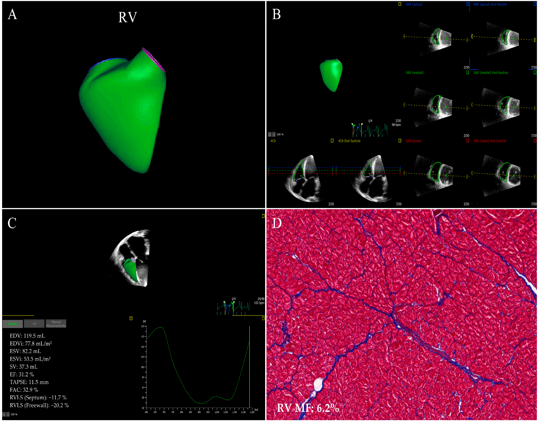 Jcm 12 00743 g002 Jcm 12 00743 g002
