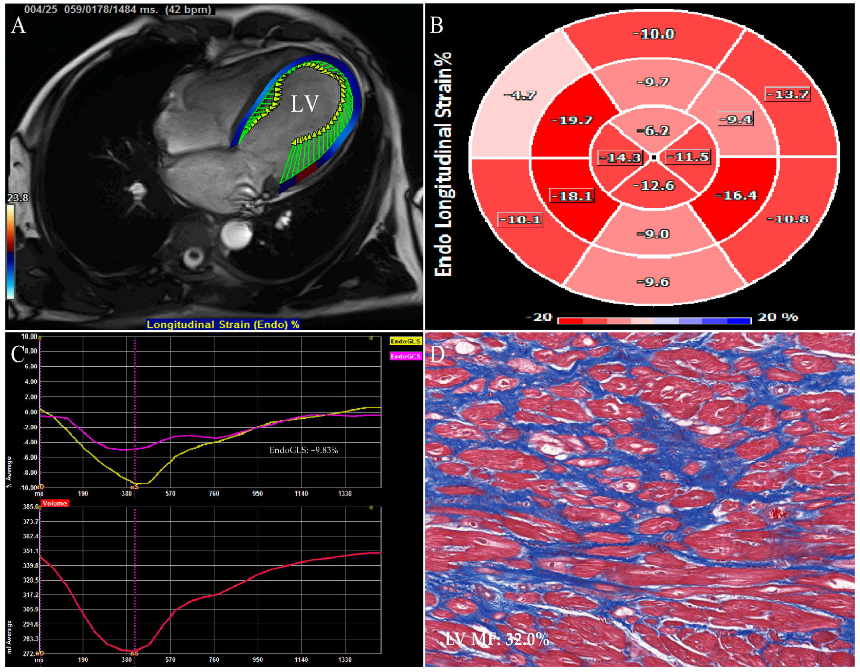 Jcm 12 00743 g003 Jcm 12 00743 g003