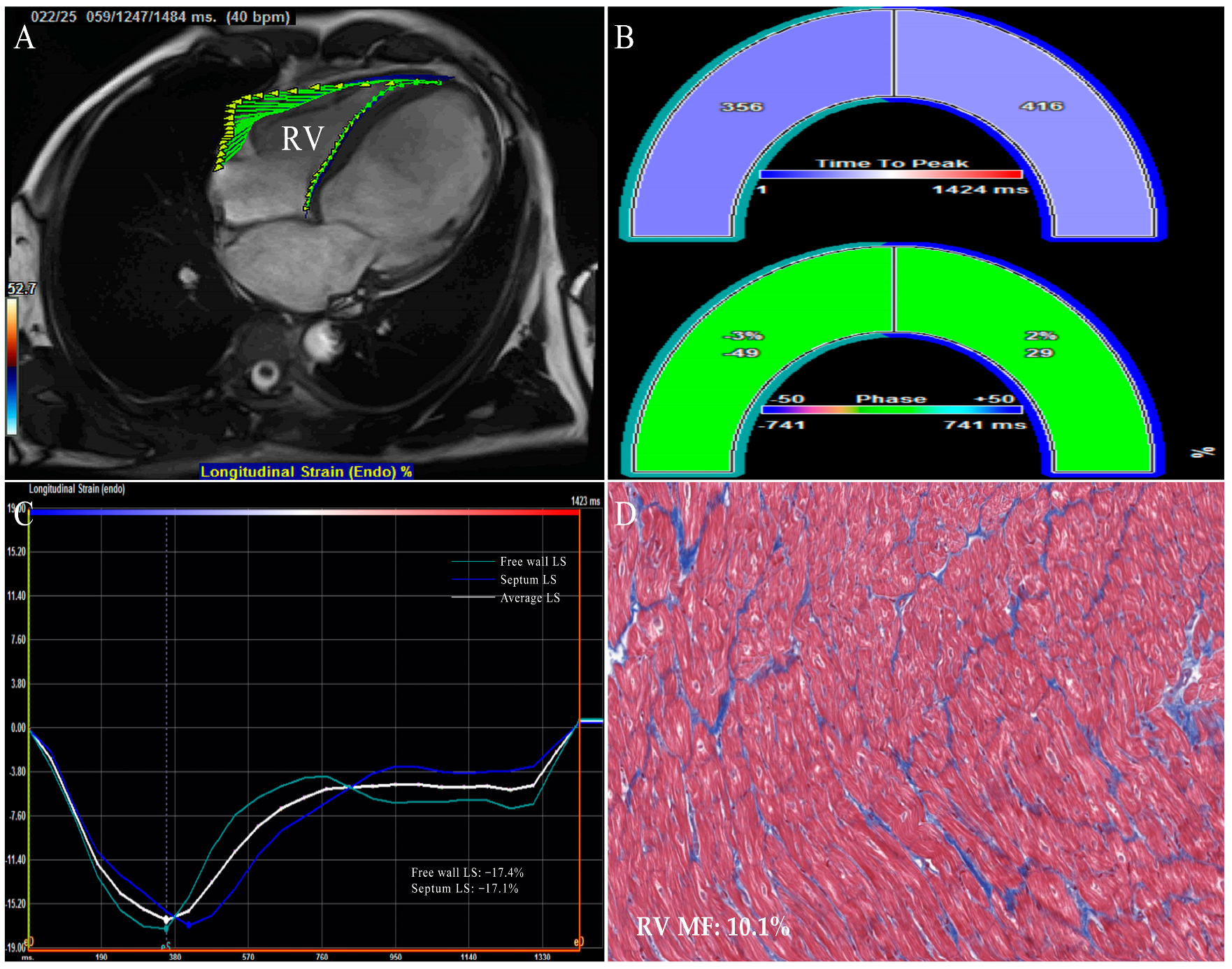 Jcm 12 00743 g004 Jcm 12 00743 g004