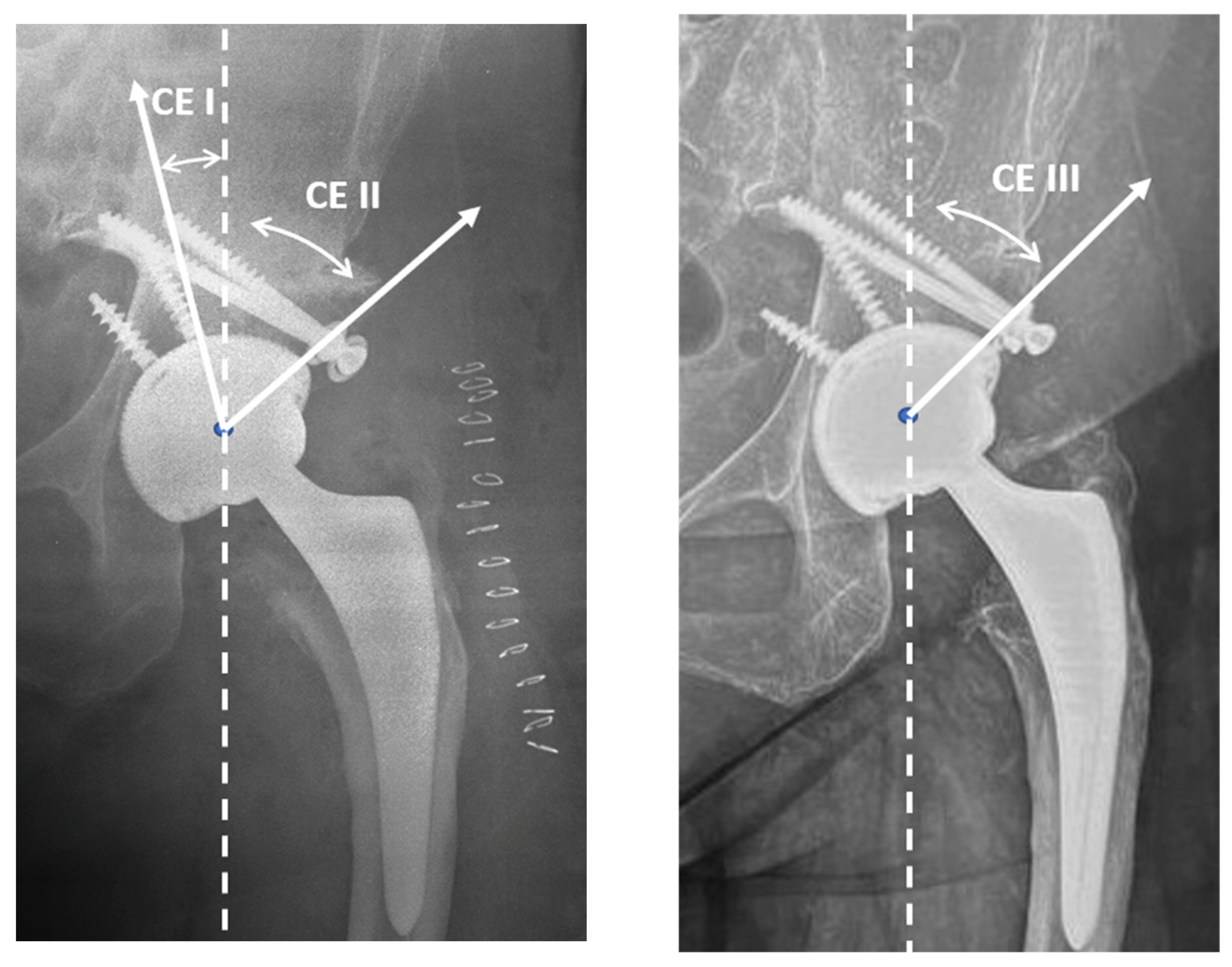 Jcm 12 00751 g003 Jcm 12 00751 g003