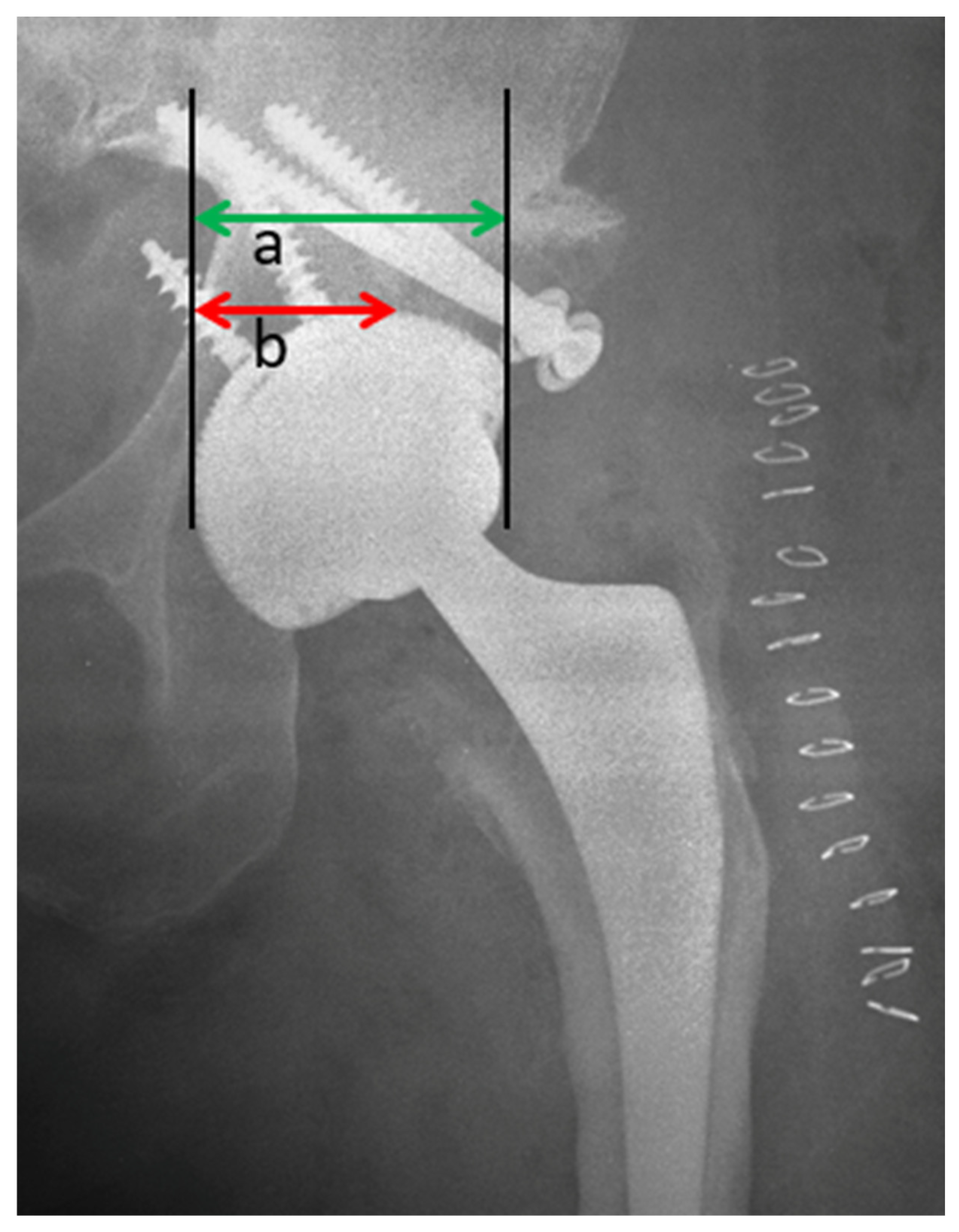 Jcm 12 00751 g004 Jcm 12 00751 g004