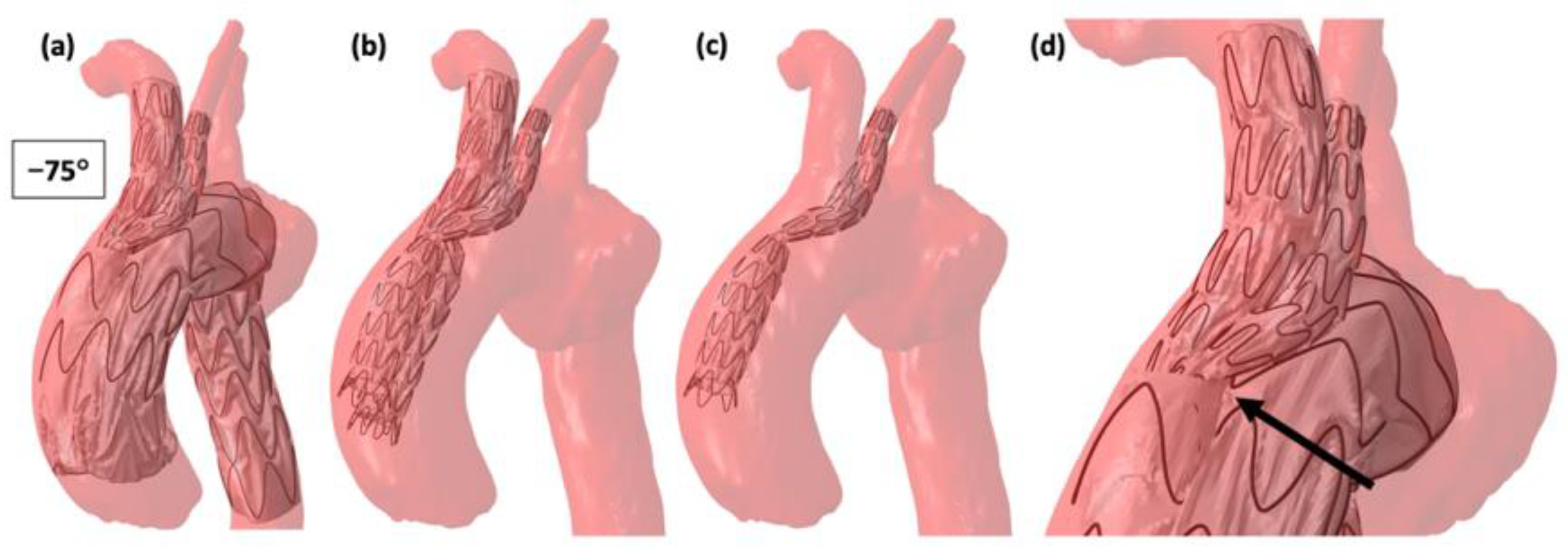 Jcm 12 00766 g005 Jcm 12 00766 g005