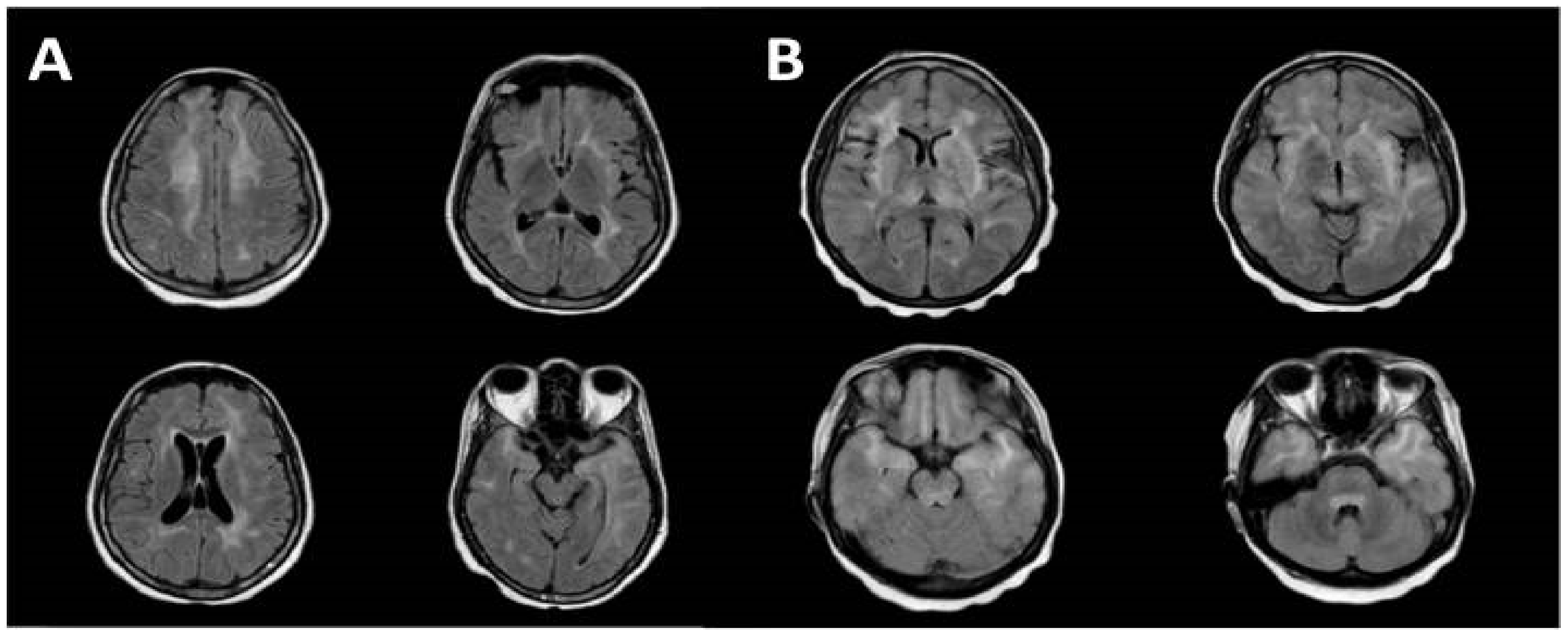Jcm 12 00770 g004 Jcm 12 00770 g004