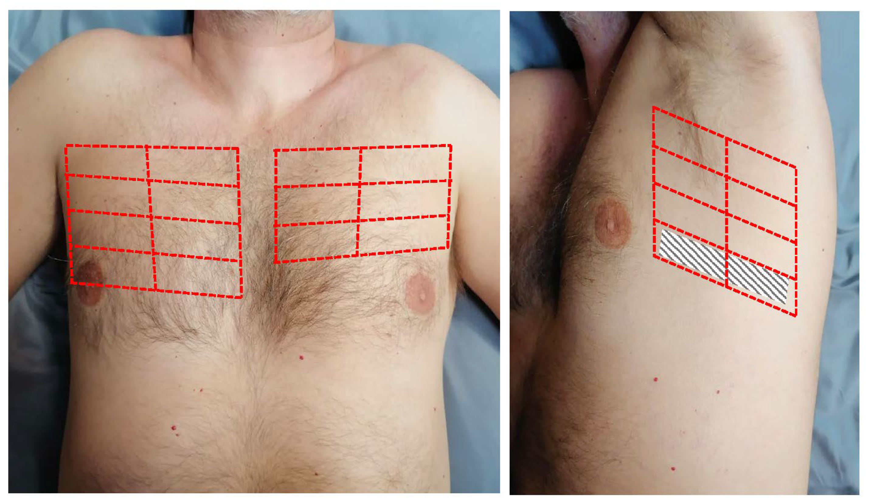 Jcm 12 00773 g001 Jcm 12 00773 g001