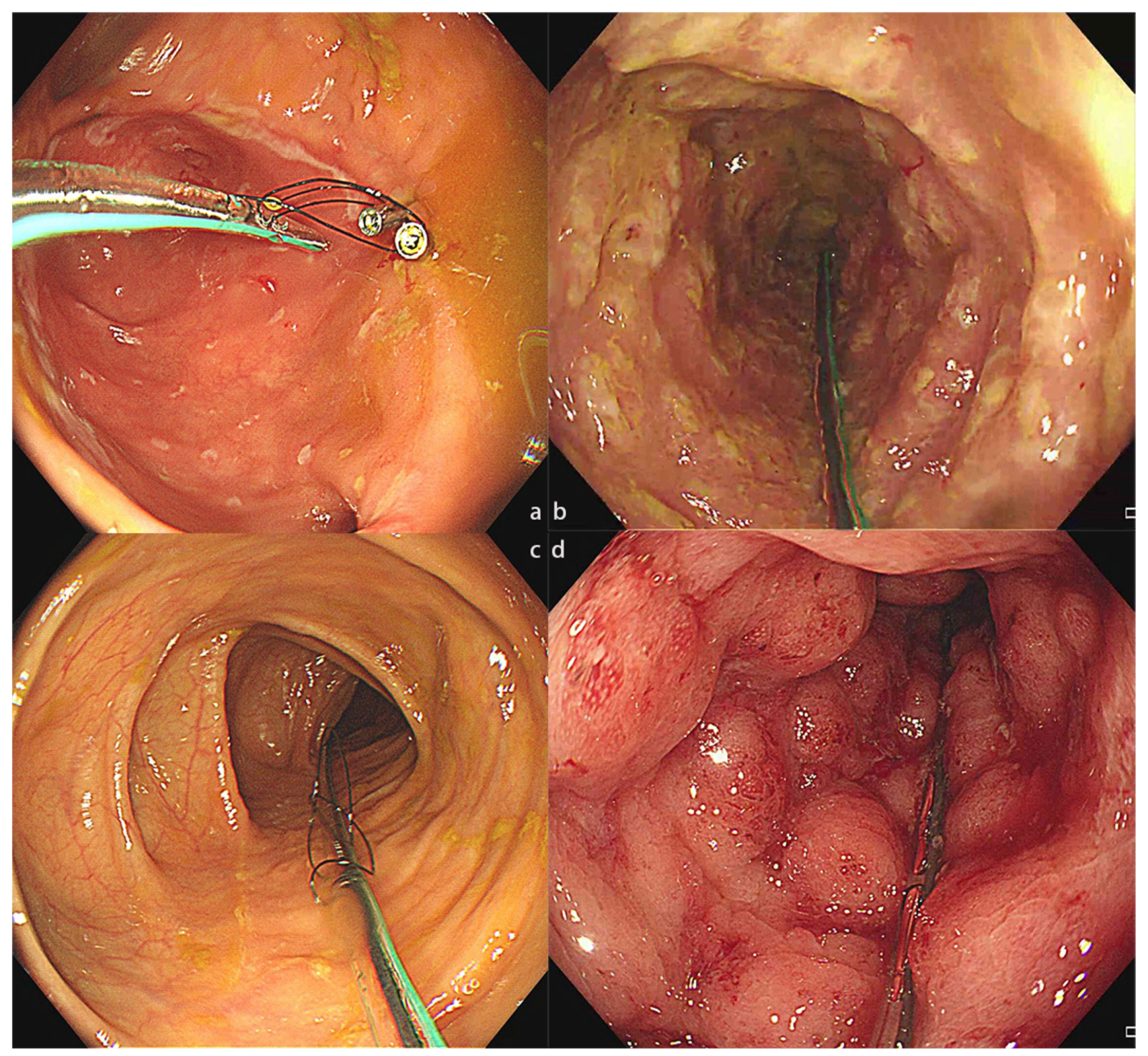 Jcm 12 00780 g002 Jcm 12 00780 g002