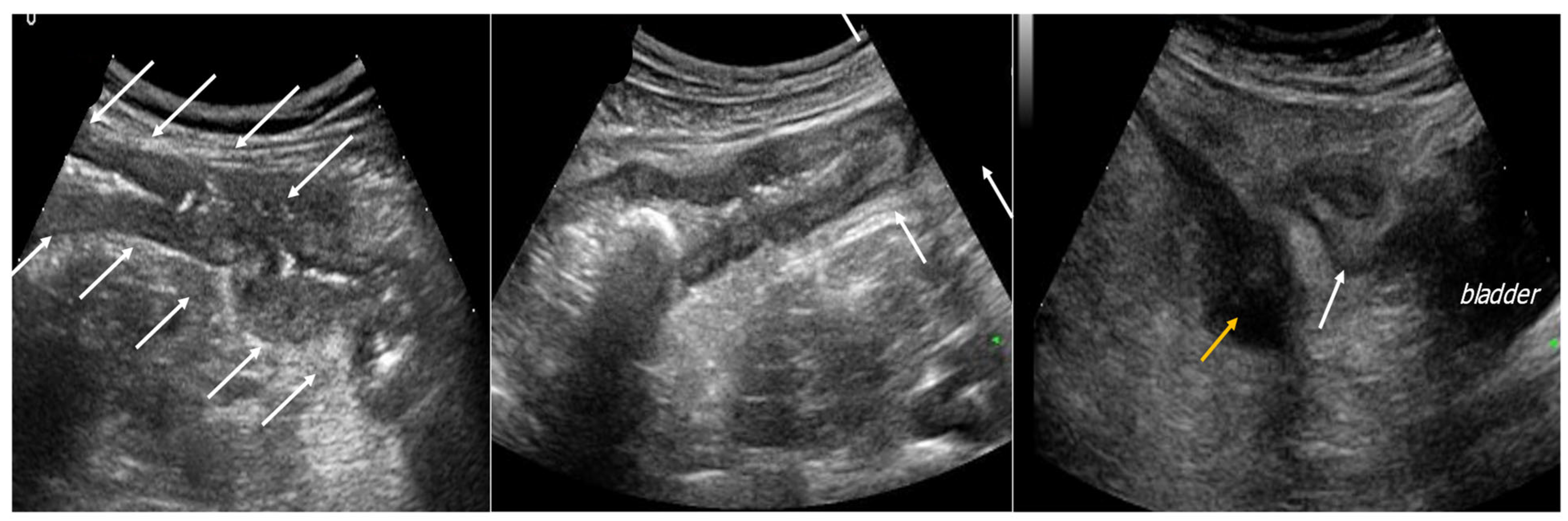 Jcm 12 00799 g003 Jcm 12 00799 g003