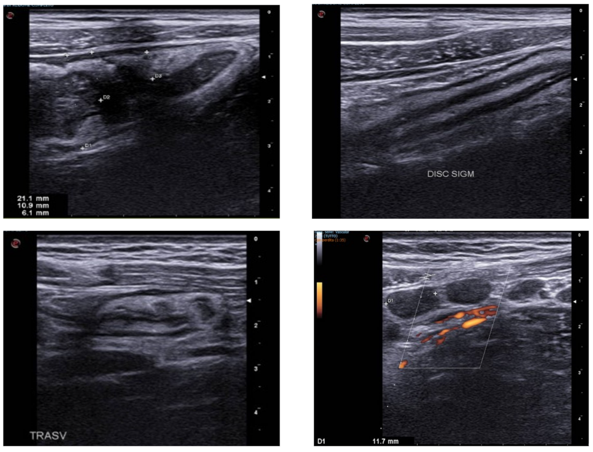 Jcm 12 00799 g004 Jcm 12 00799 g004