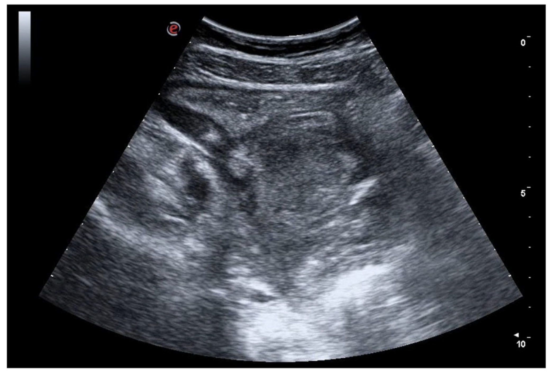 Jcm 12 00799 g005 Jcm 12 00799 g005