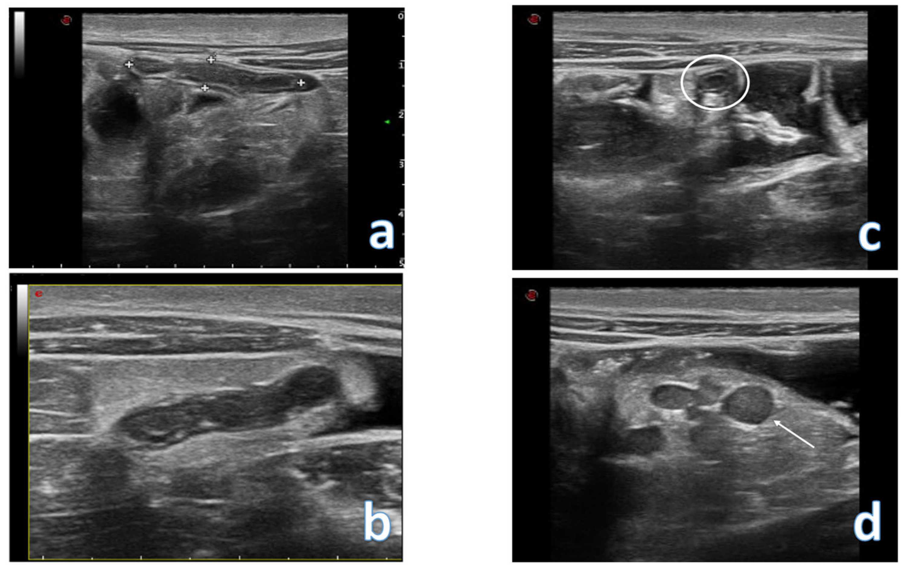 Jcm 12 00799 g007 Jcm 12 00799 g007