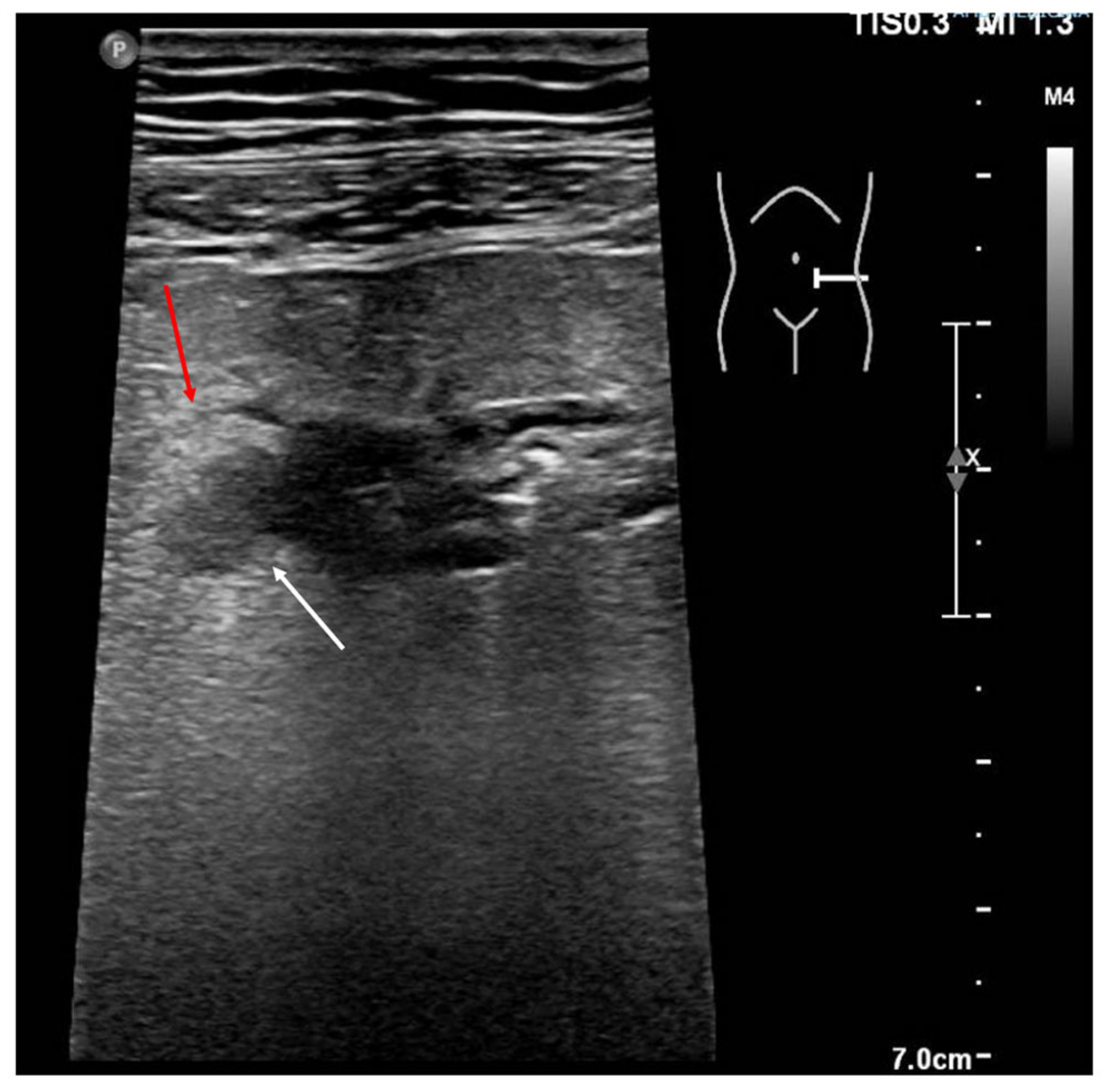 Jcm 12 00799 g009 Jcm 12 00799 g009