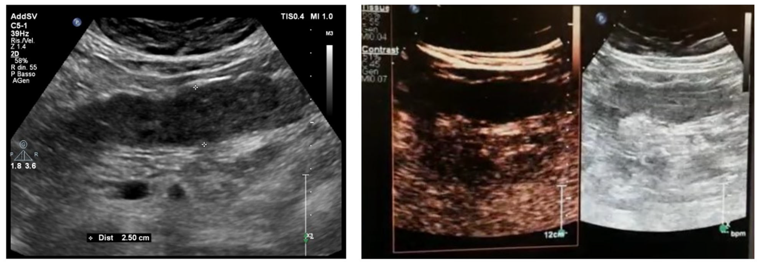 Jcm 12 00799 g014 Jcm 12 00799 g014