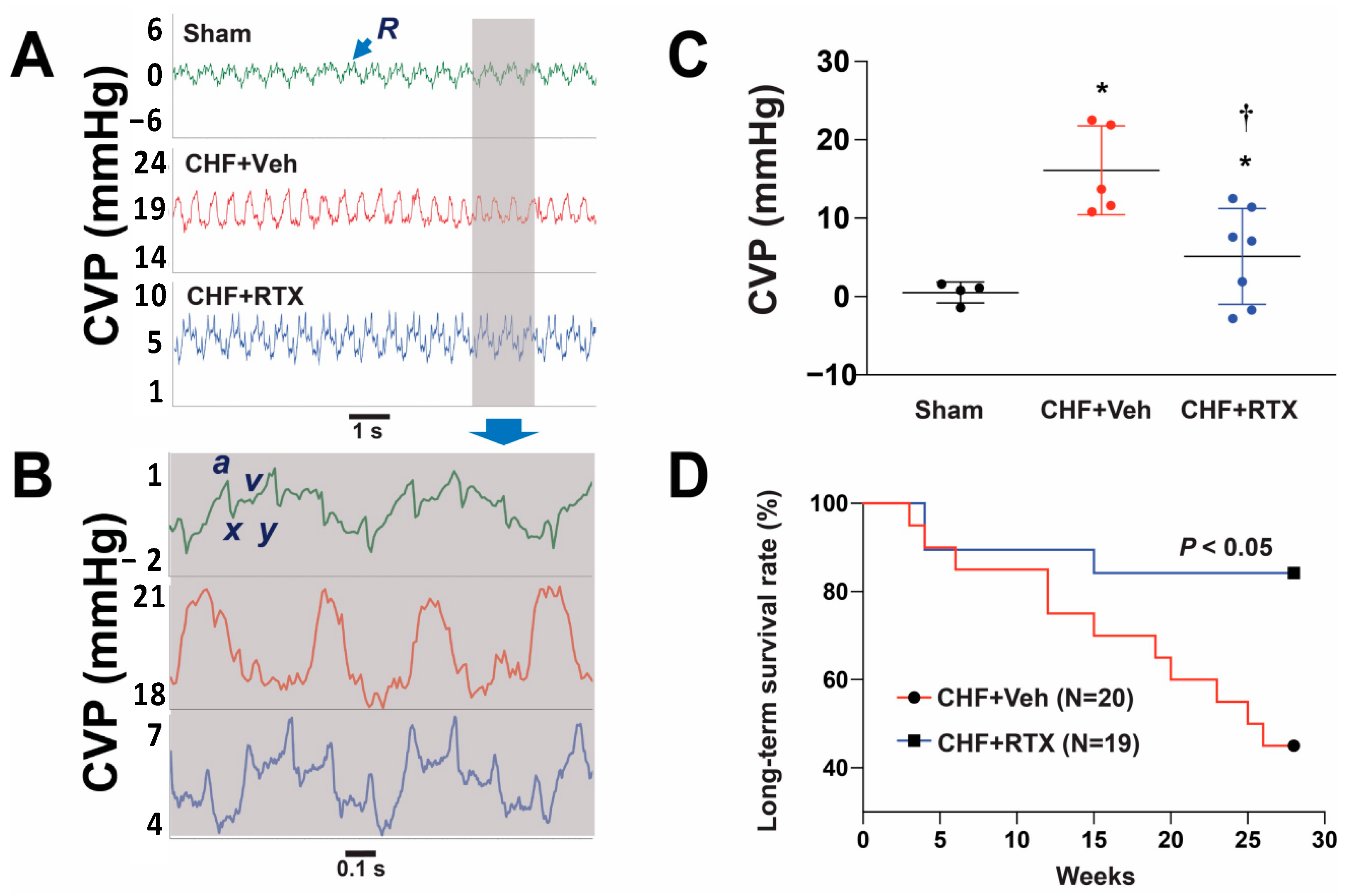 優先配送 of Neuromodulation Potential the Syndrome Cardio-Renal トリートメント