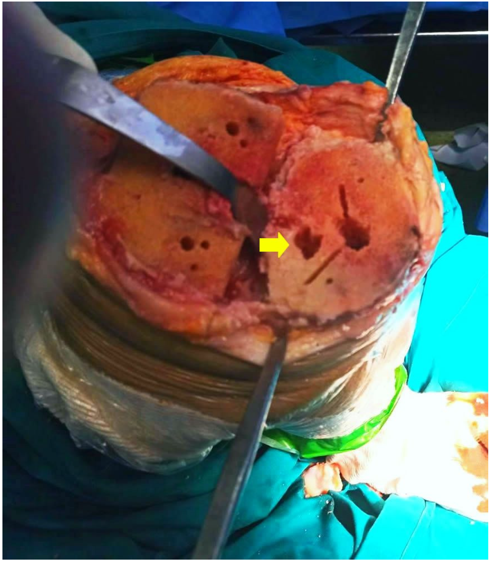 Jcm 12 00815 g003 Jcm 12 00815 g003