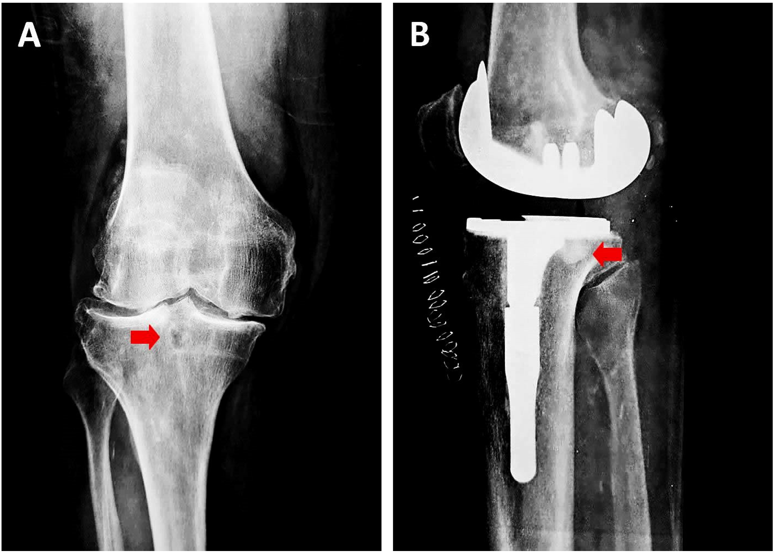 Jcm 12 00815 g004 Jcm 12 00815 g004