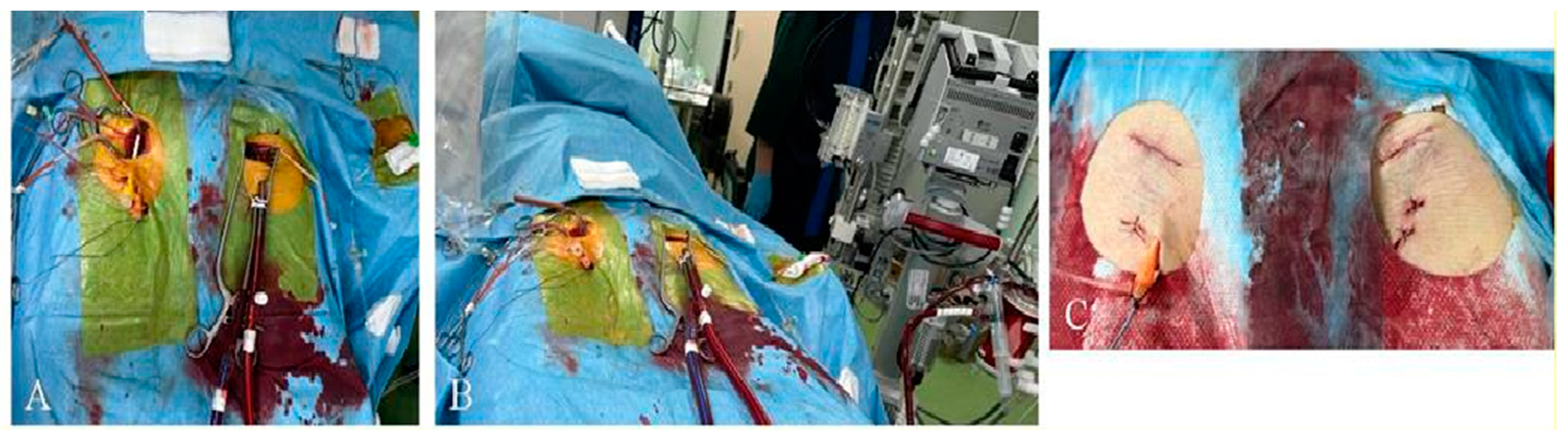 Jcm 12 00859 g002 Jcm 12 00859 g002