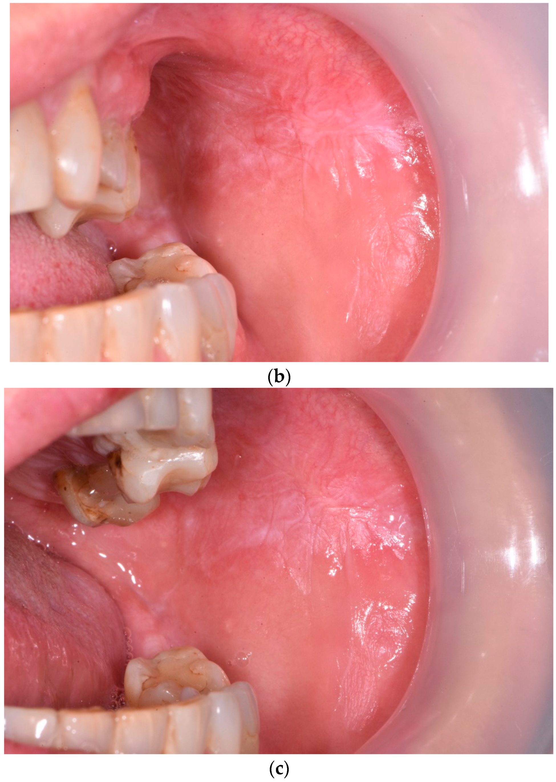 Jcm 12 00875 g002b Jcm 12 00875 g002b