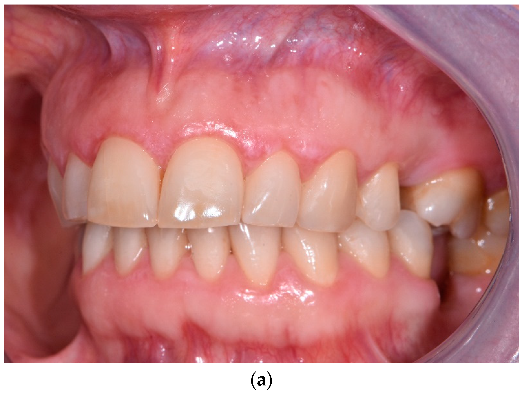 Jcm 12 00875 g003a Jcm 12 00875 g003a