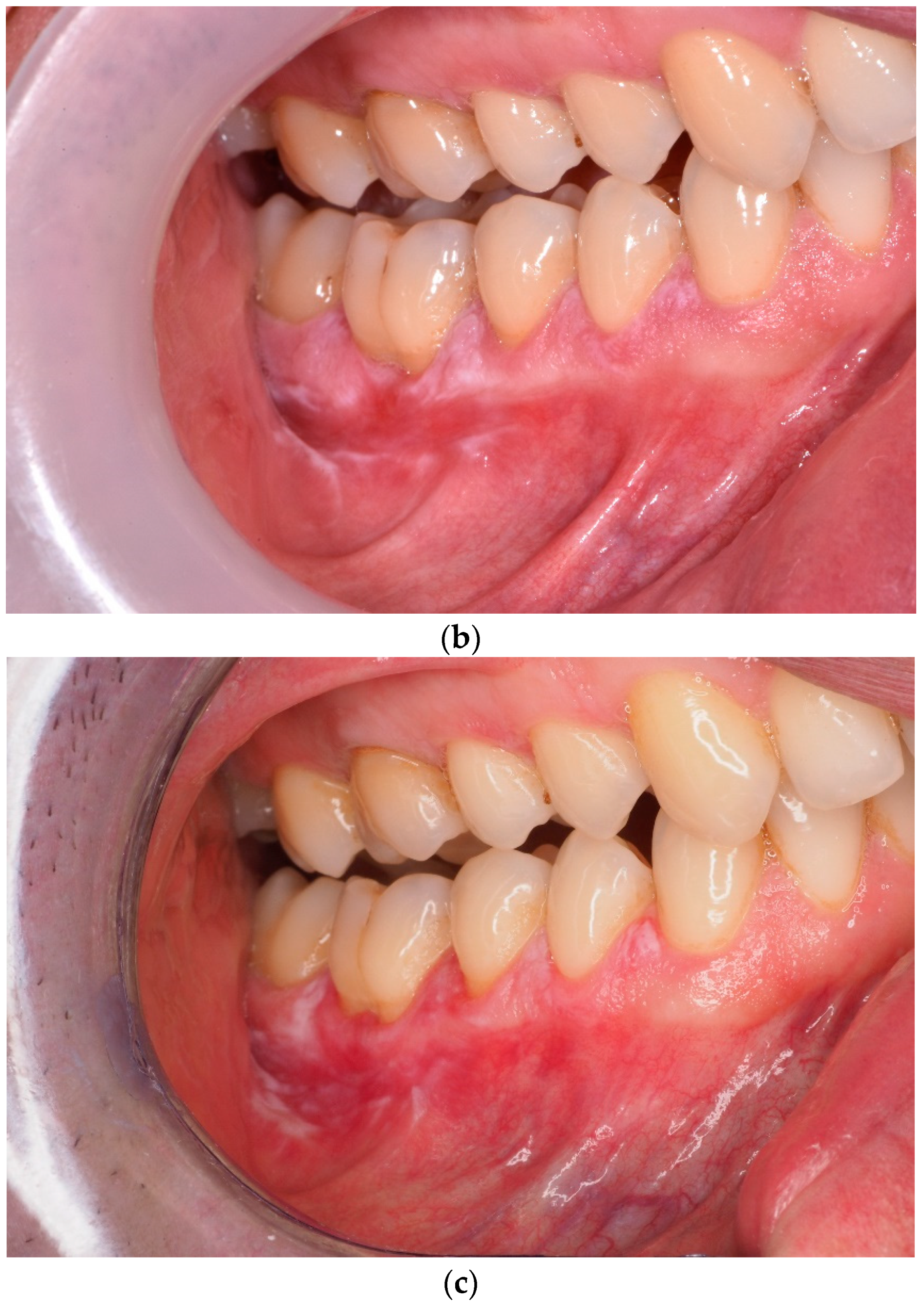 Jcm 12 00875 g004b Jcm 12 00875 g004b