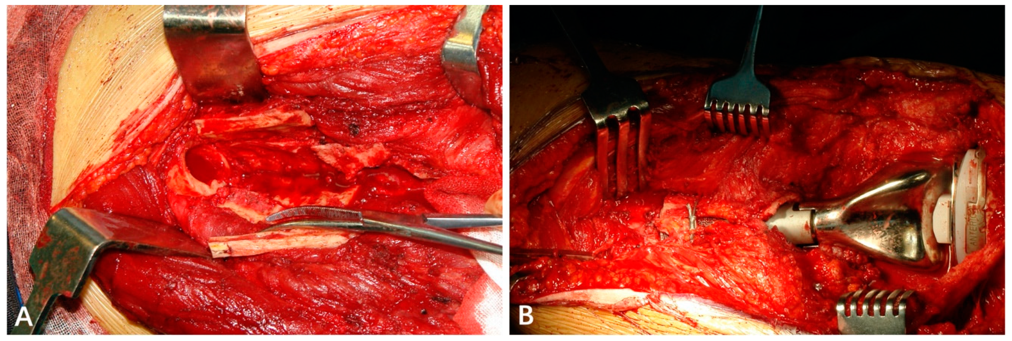 Jcm 12 00892 g002 Jcm 12 00892 g002