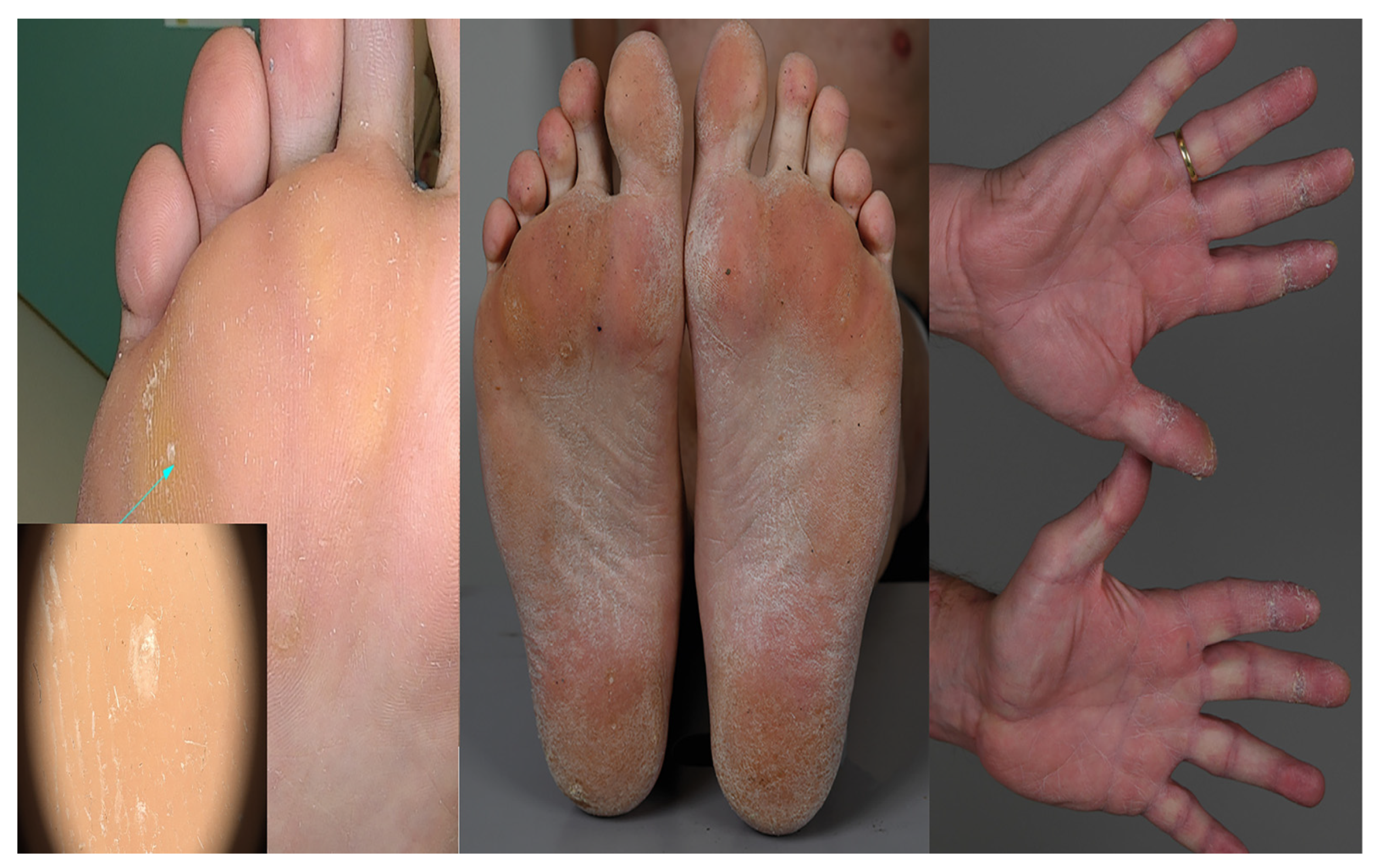 Jcm 12 00913 g001 Jcm 12 00913 g001