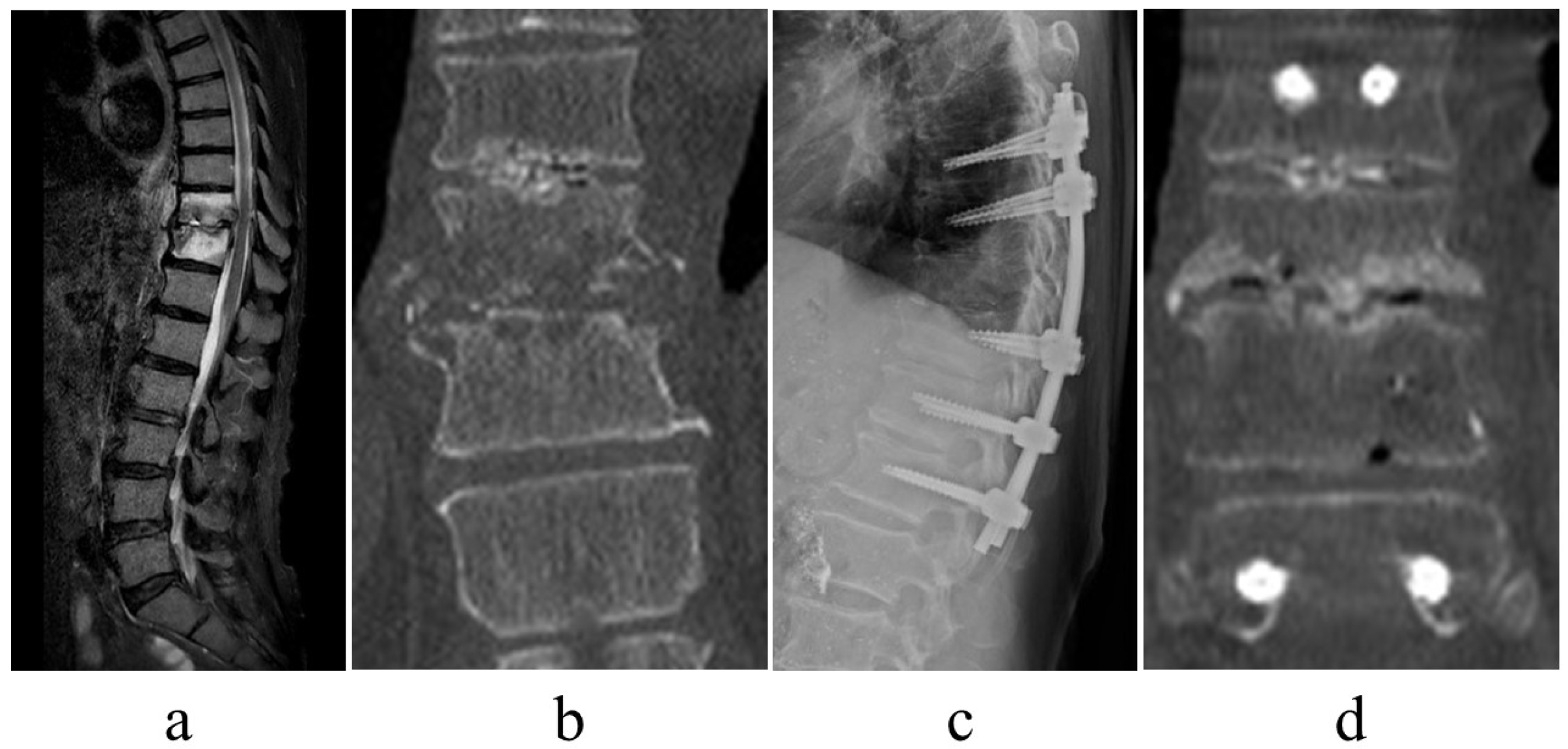 Jcm 12 00932 g003 Jcm 12 00932 g003