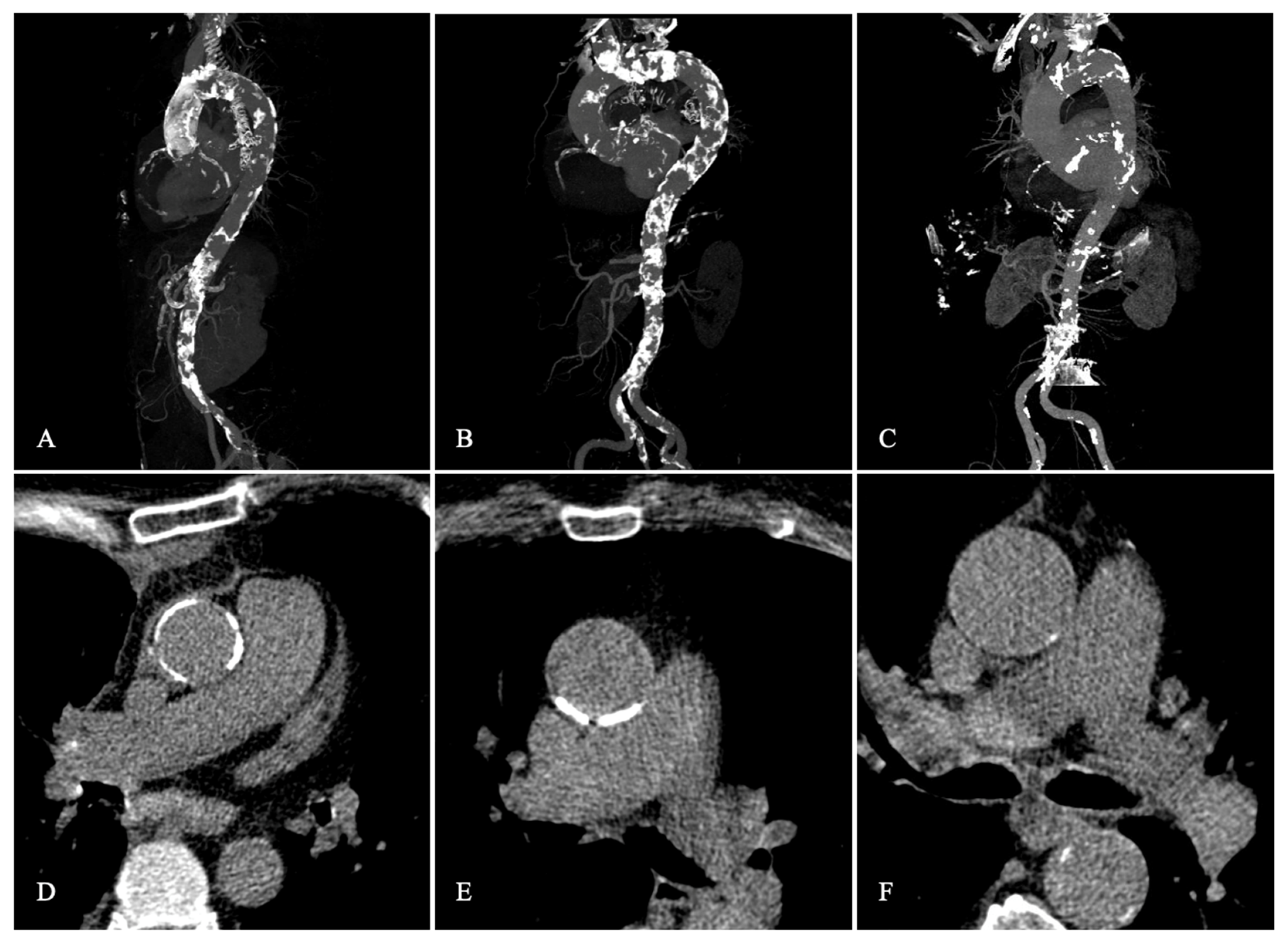 Jcm 12 00945 g001 Jcm 12 00945 g001