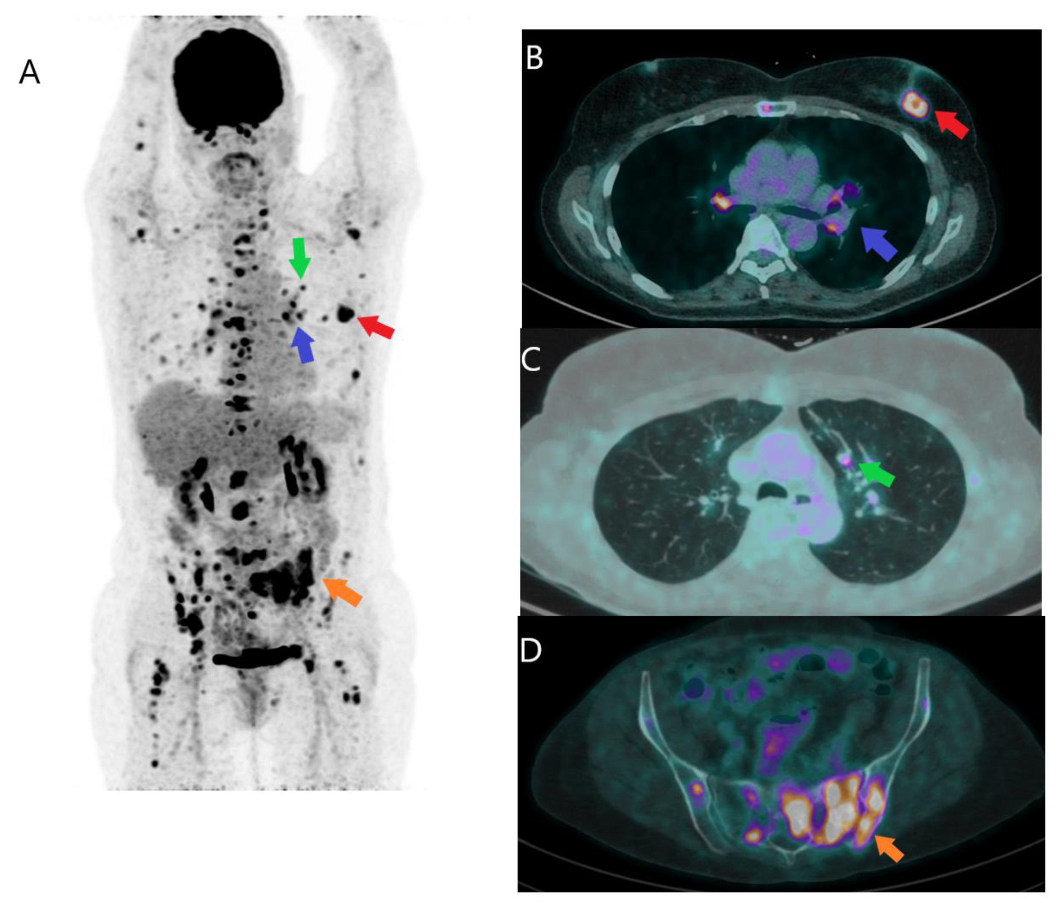 Jcm 12 00968 g002 Jcm 12 00968 g002