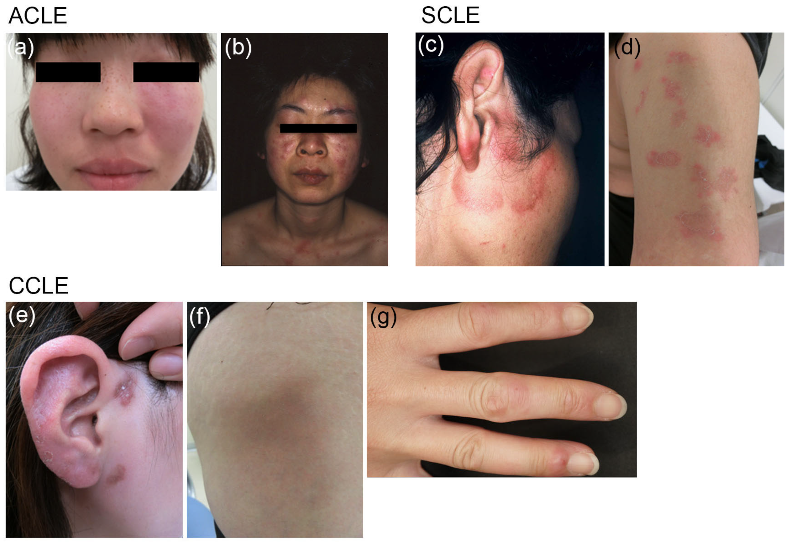 ホット商品 Molecular the of Knowledge Current Pathogenesis Cutaneous of 臨床医学