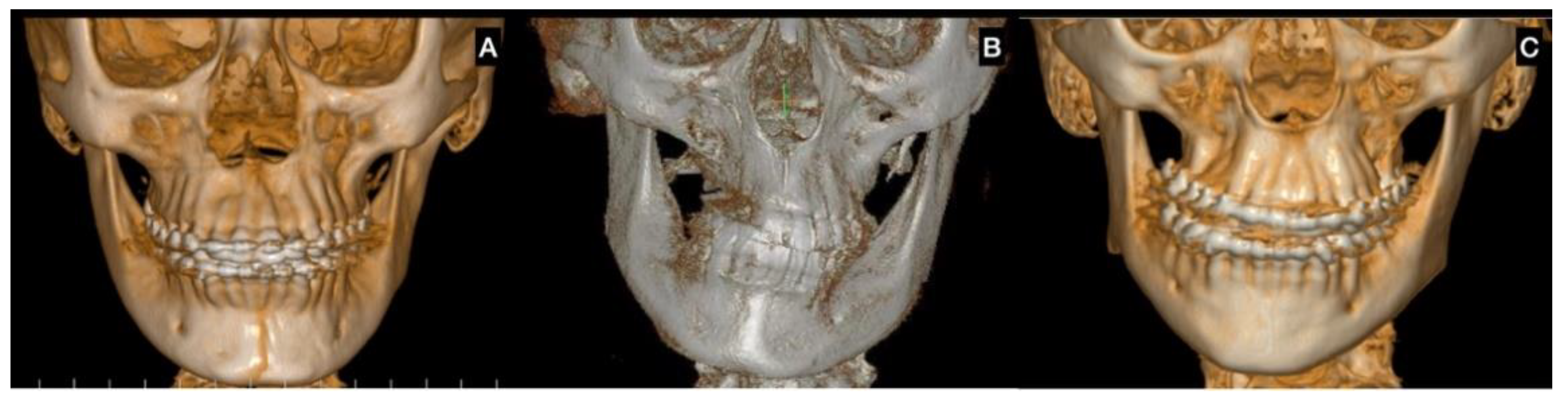 Jcm 12 01017 g002 Jcm 12 01017 g002