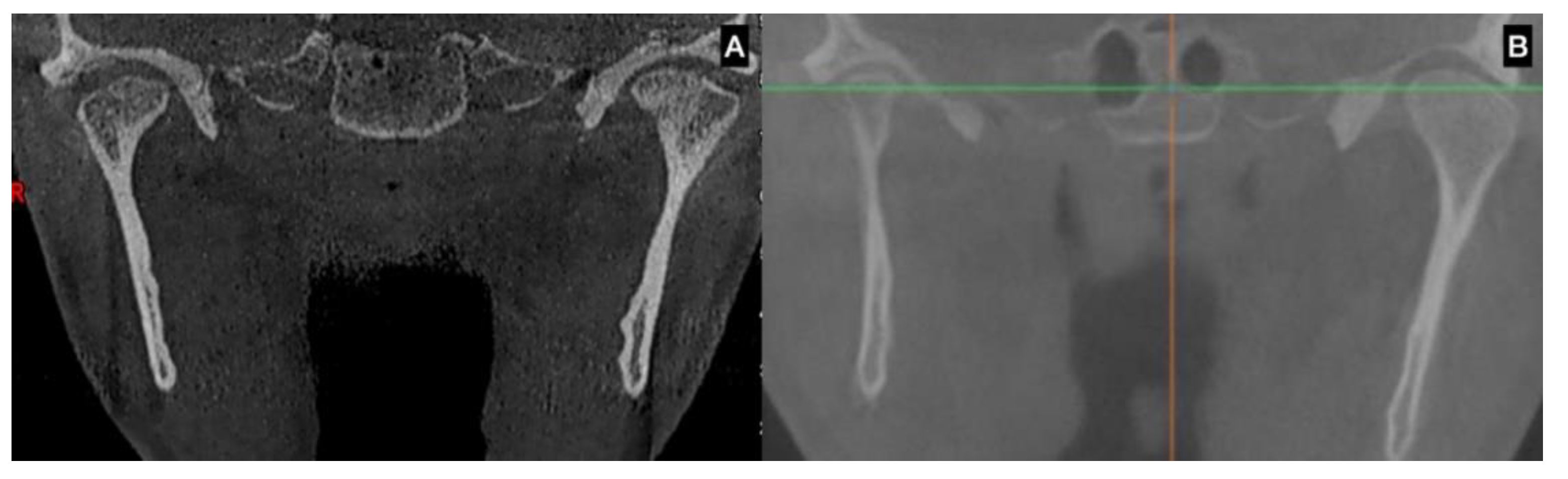 Jcm 12 01017 g003 Jcm 12 01017 g003