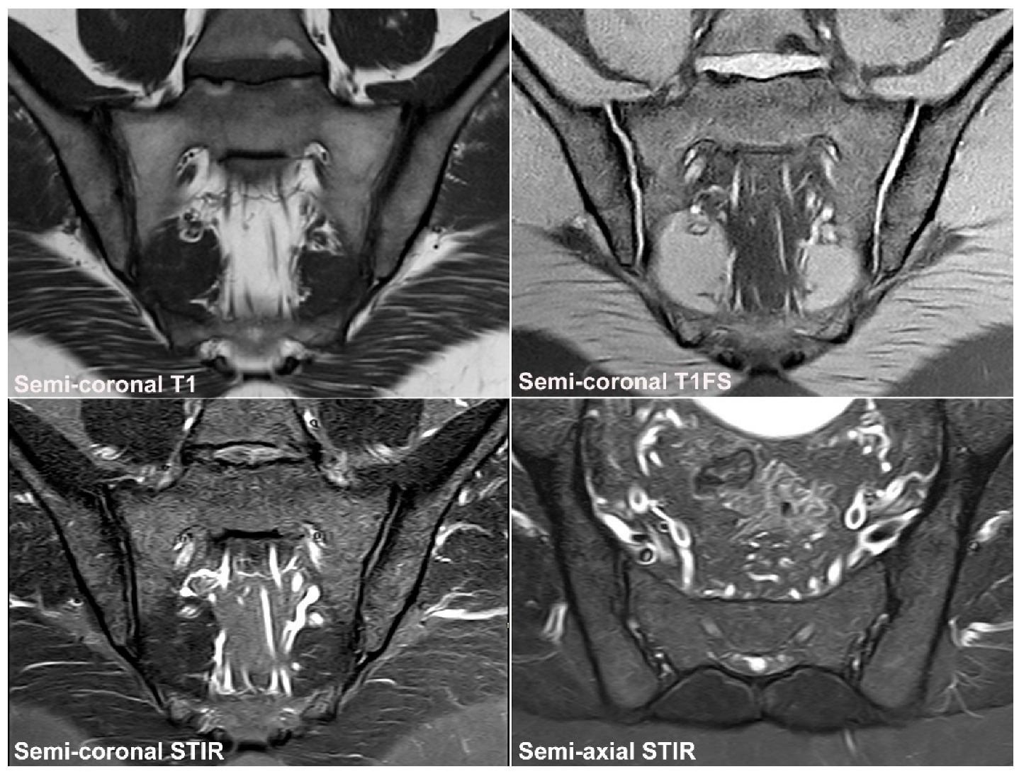 JCM Free FullText Diagnostics of Sacroiliac Joint Differentials to