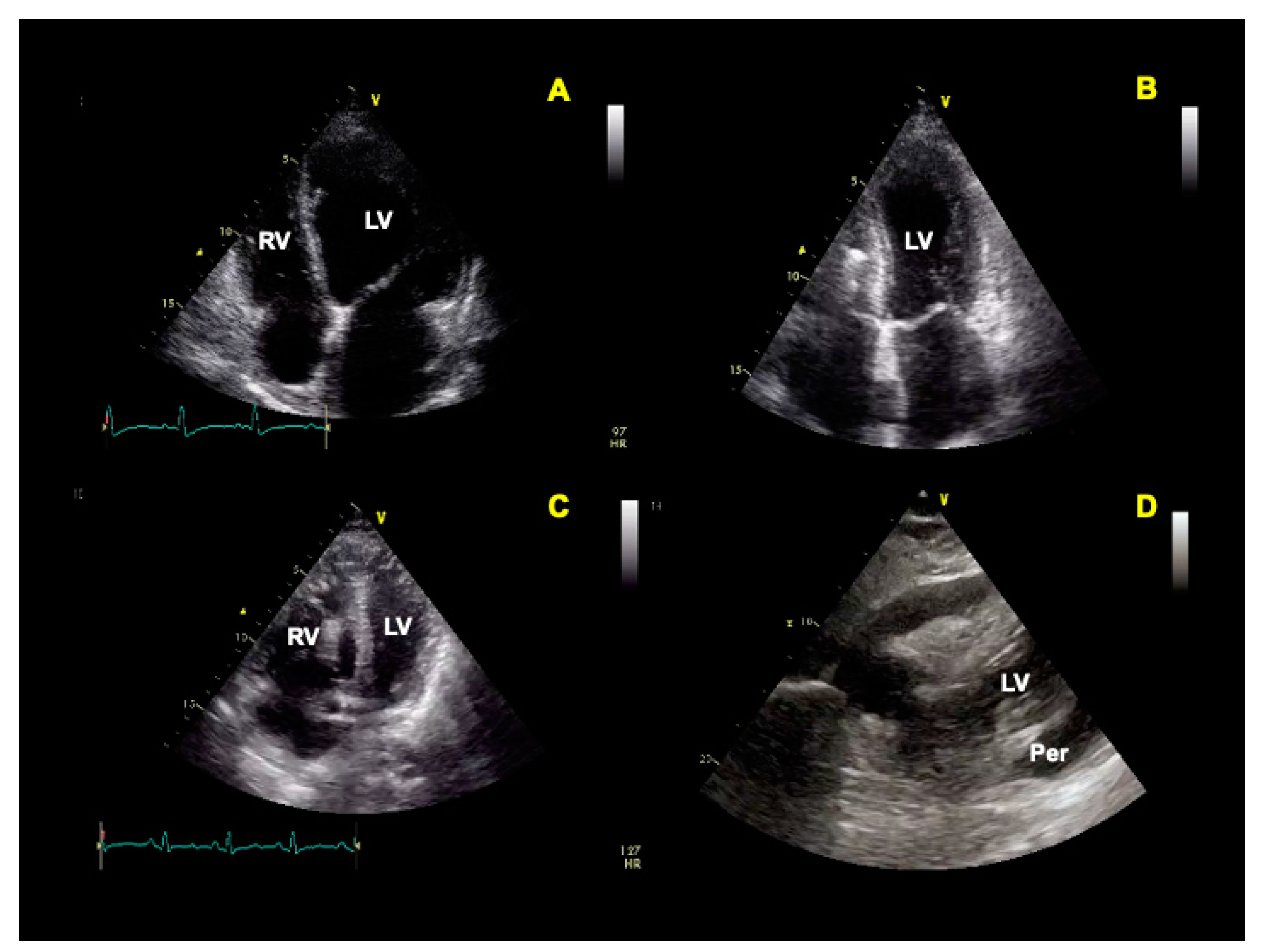 Jcm 12 01057 g002 Jcm 12 01057 g002