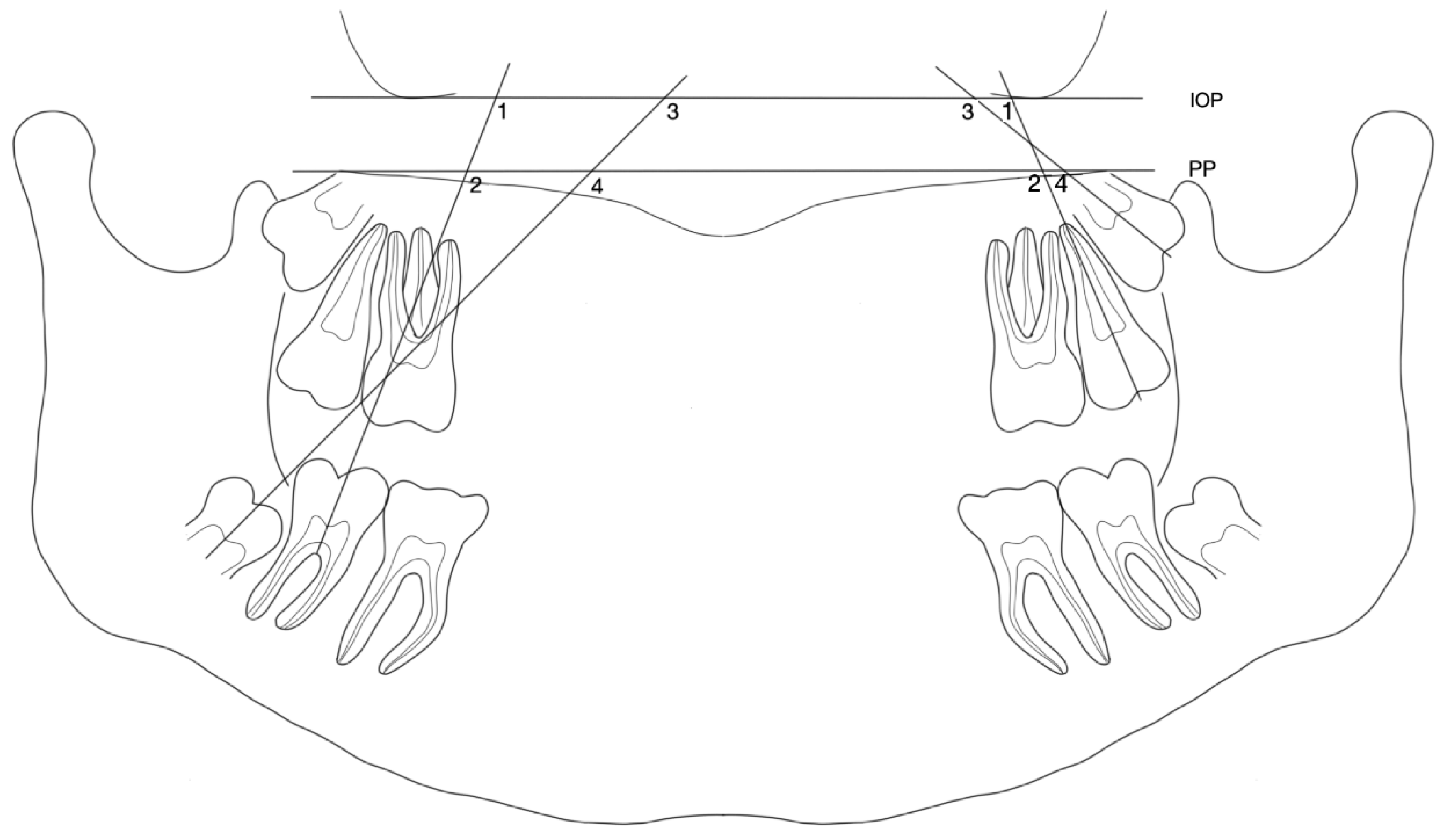 Jcm 12 01060 g001 Jcm 12 01060 g001