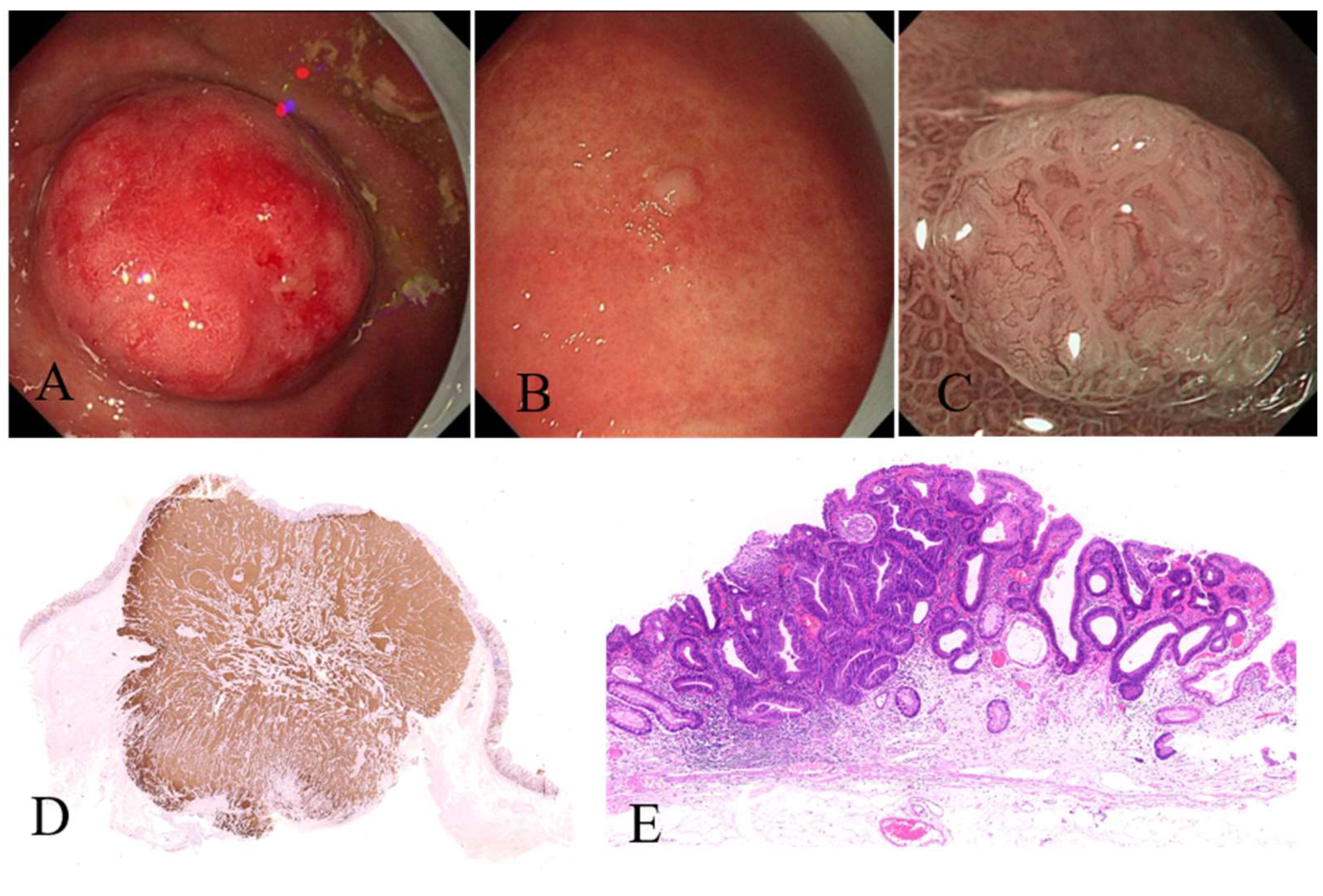 Jcm 12 01062 g005 Jcm 12 01062 g005