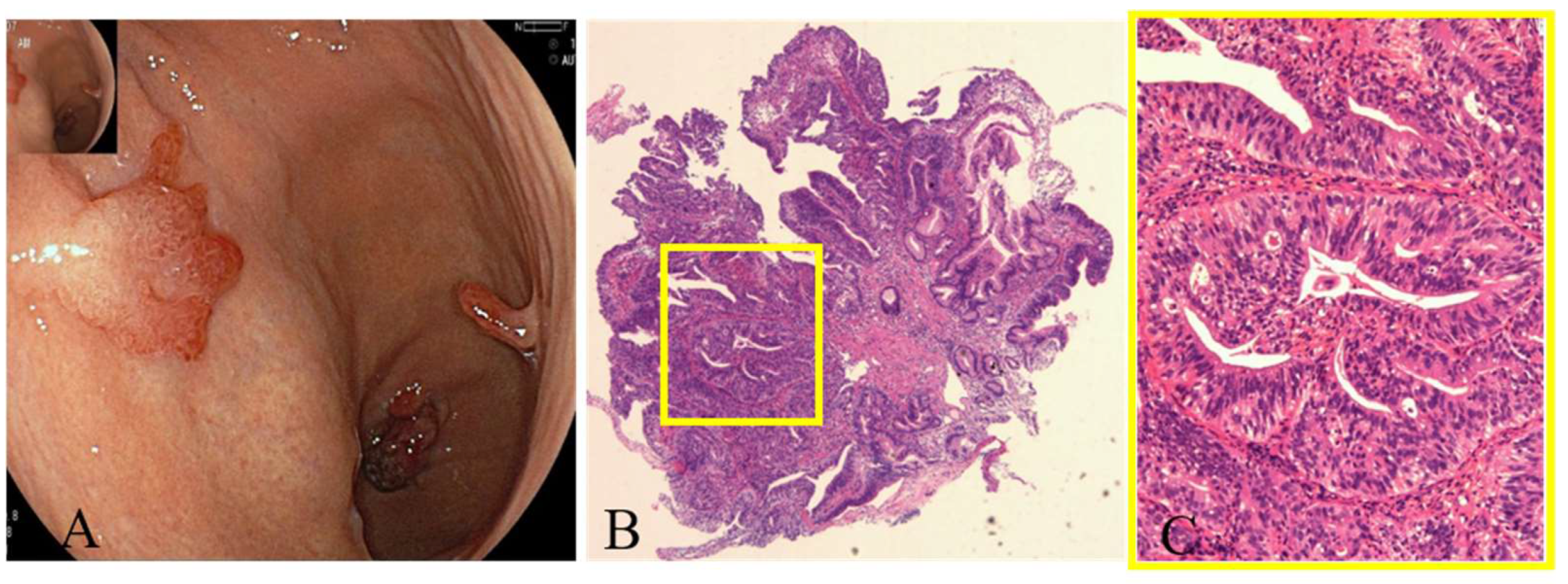 Jcm 12 01062 g006 Jcm 12 01062 g006