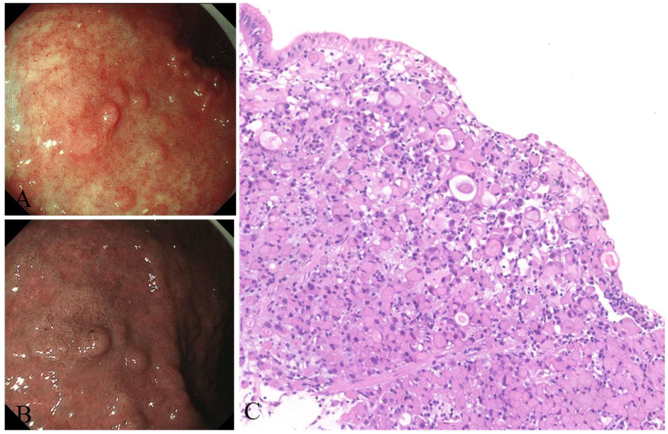 Jcm 12 01062 g007 Jcm 12 01062 g007