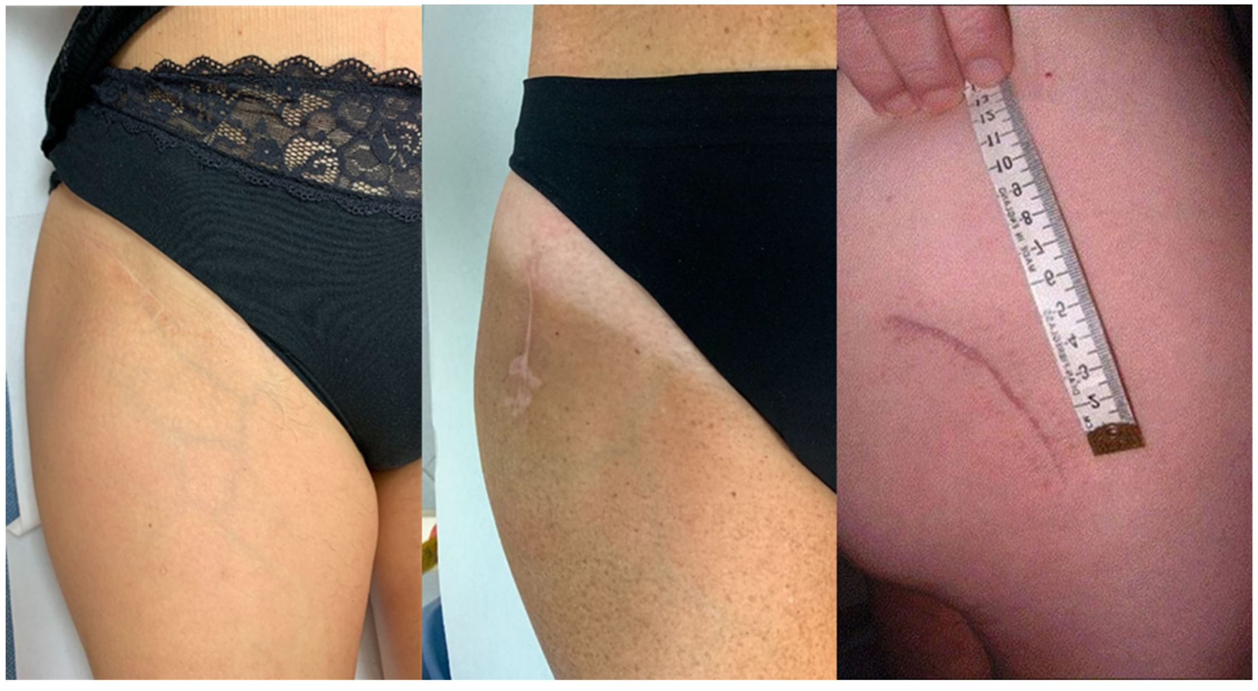 Jcm 12 01072 g002 Jcm 12 01072 g002