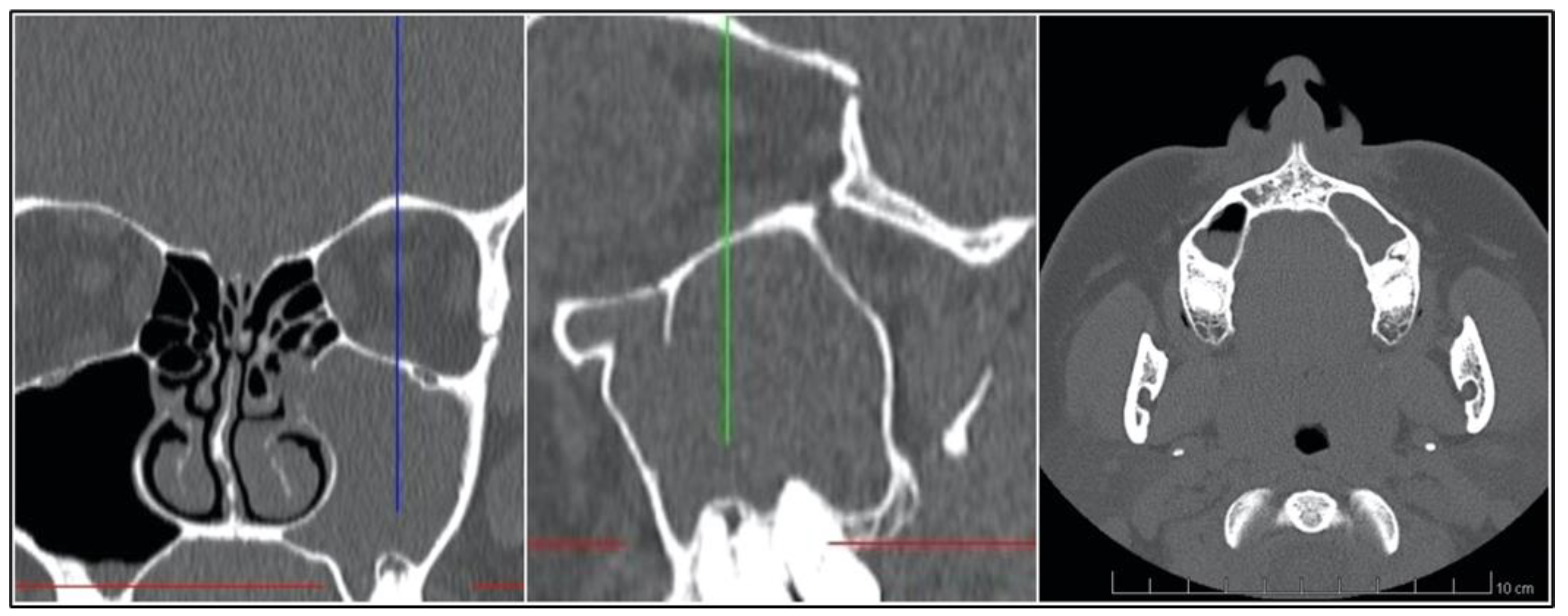 Jcm 12 01103 g001 Jcm 12 01103 g001