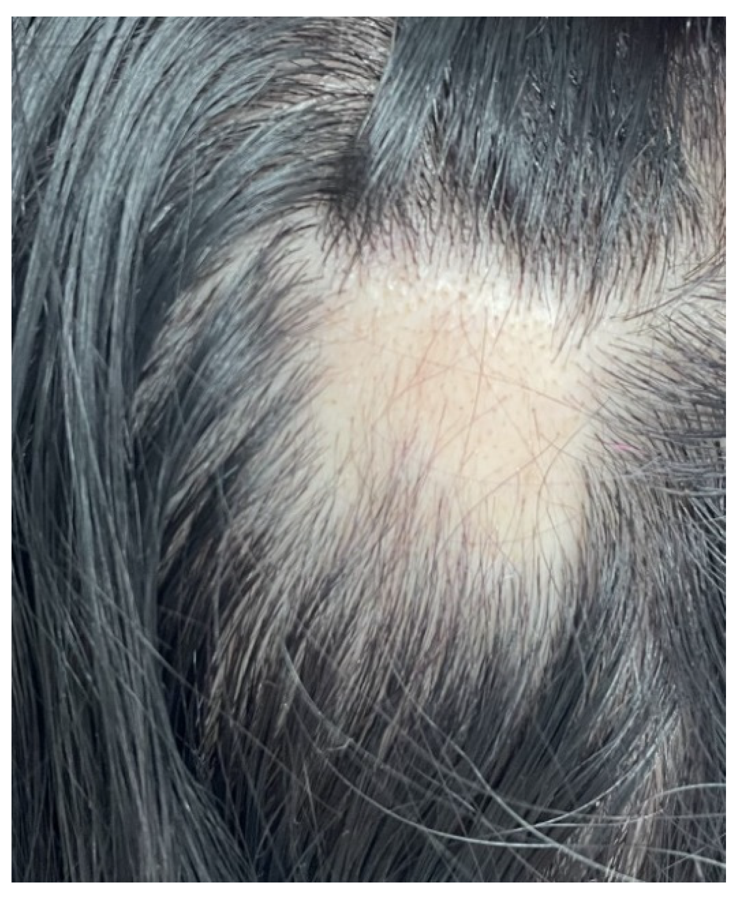 JCM Free Full Text Study Of The Thyroid Profile Of Patients With 