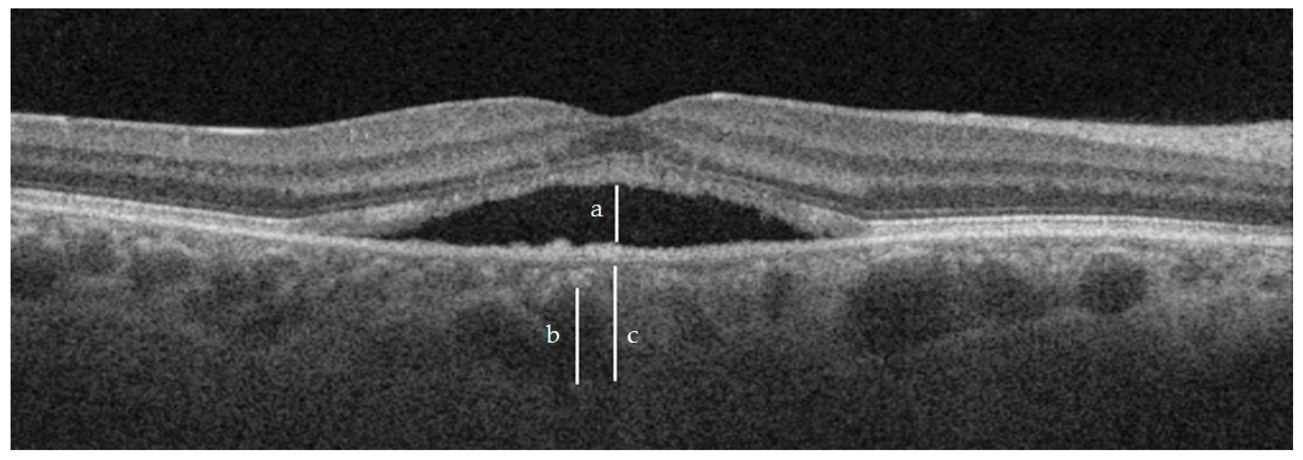 Jcm 12 01127 g001 Jcm 12 01127 g001