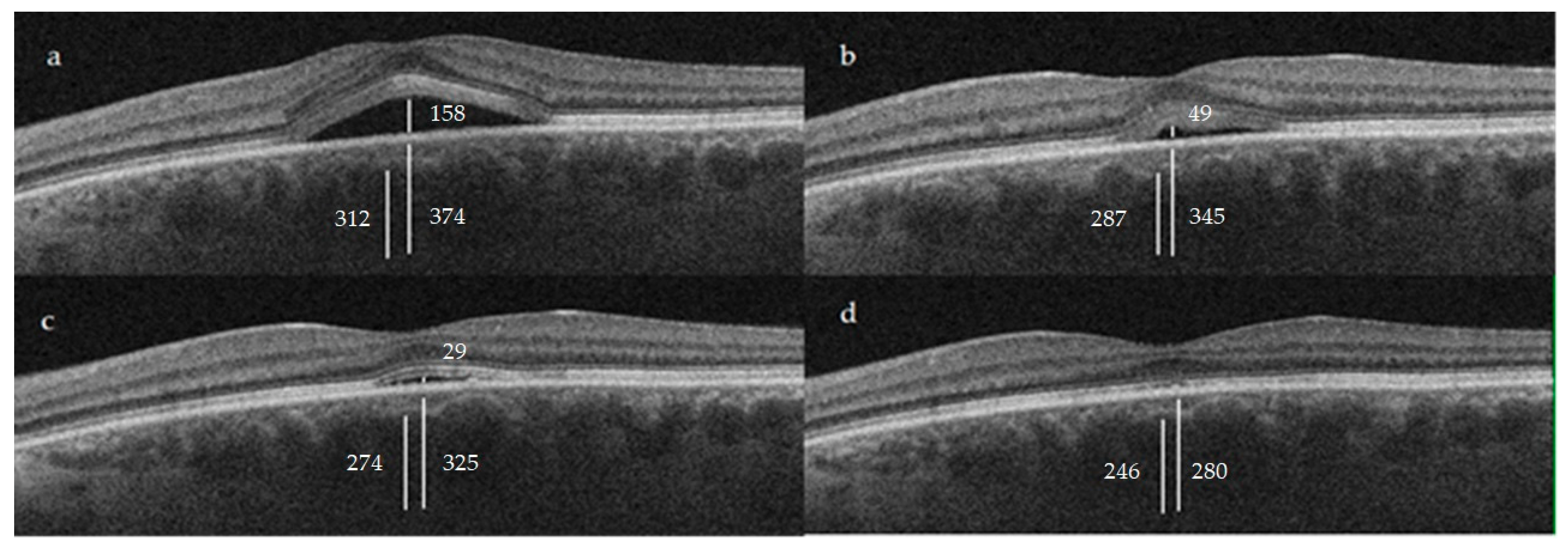 Jcm 12 01127 g002 Jcm 12 01127 g002