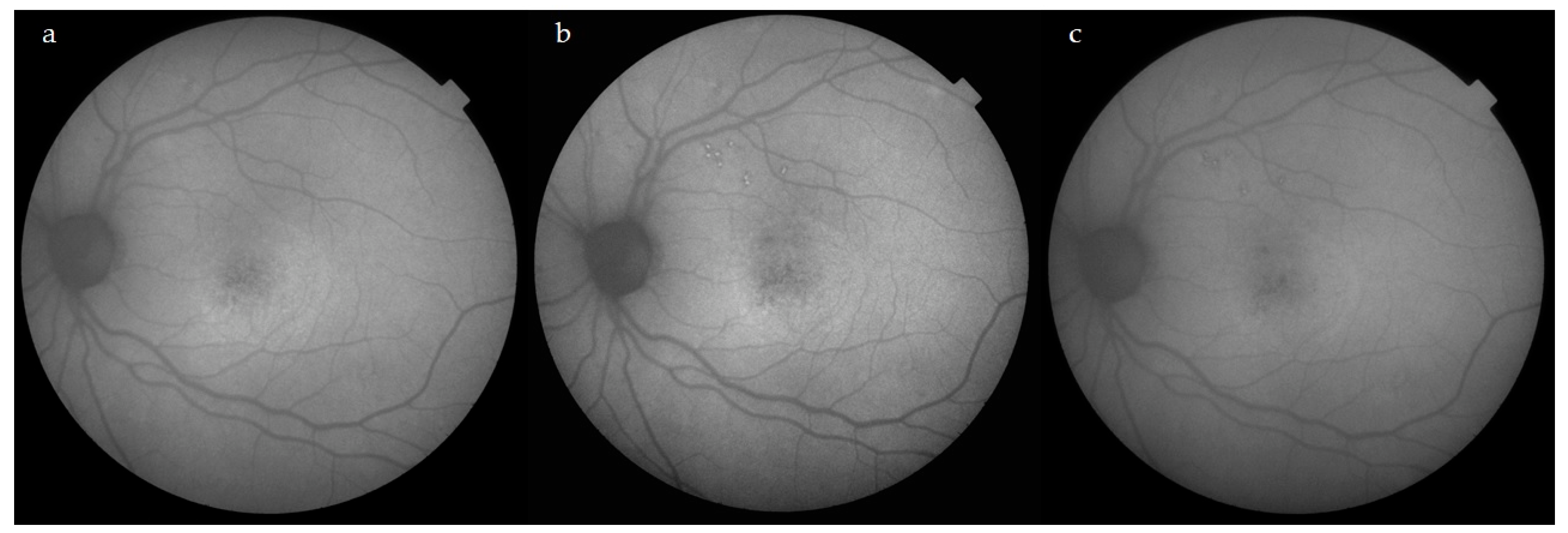 Jcm 12 01127 g004 Jcm 12 01127 g004