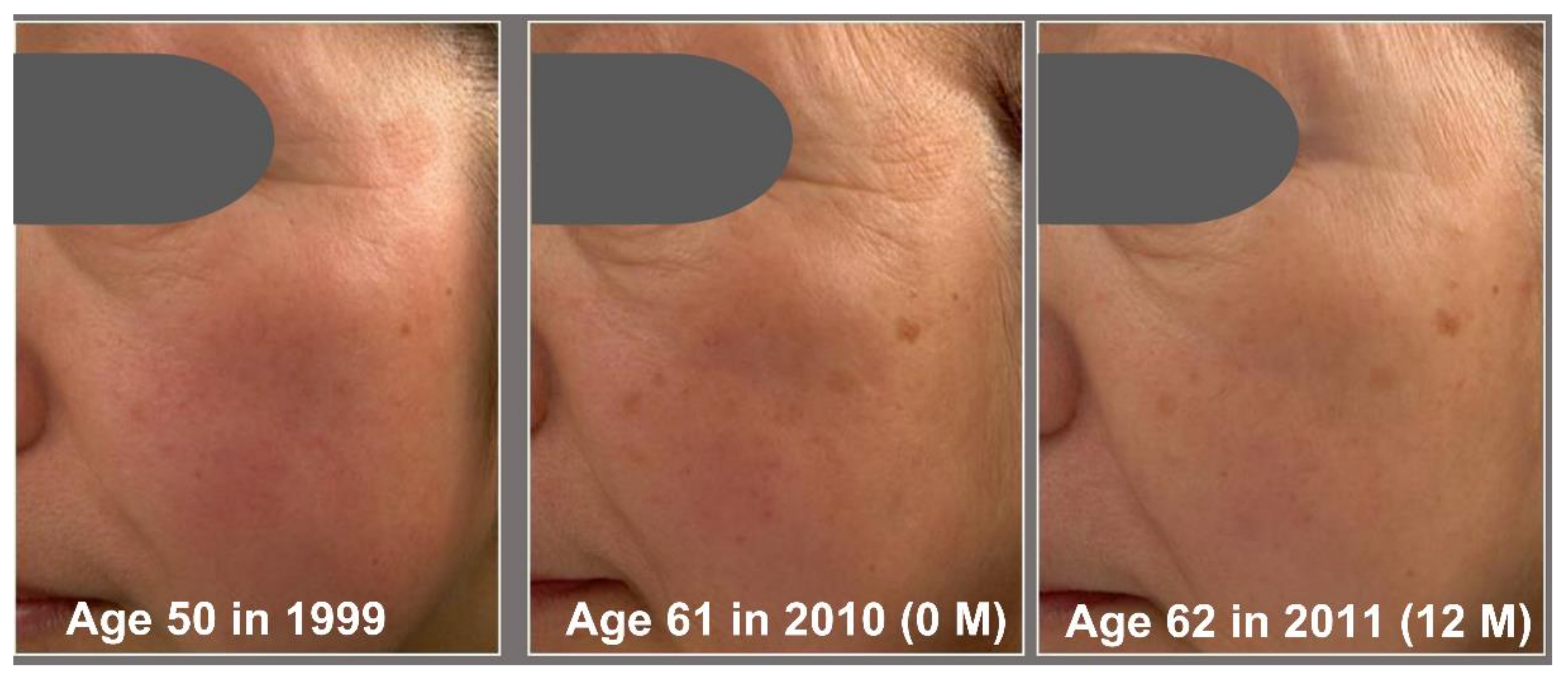 Jcm 12 01168 g007 550