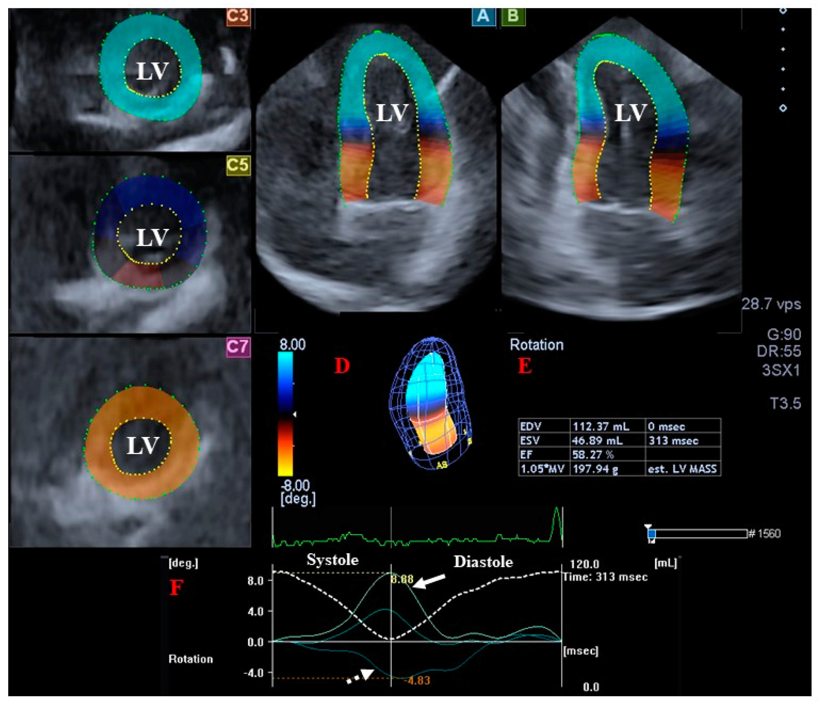 A review of current trends in three-dimensional analysis of left  ventricular myocardial strain, Cardiovascular Ultrasound